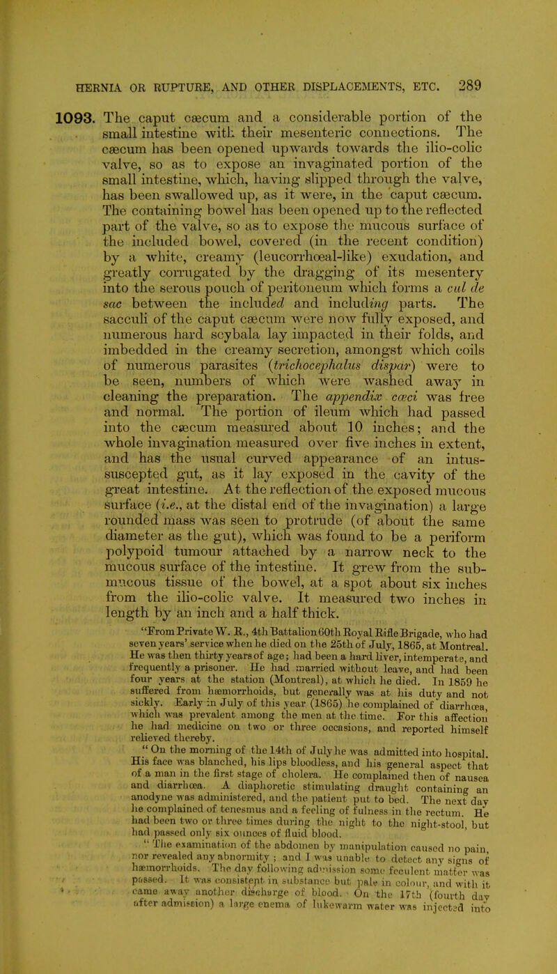 1093. The caput csecum and a considerable portion of the small intestine with their mesenteric connections. The caecum has been opened upwards towards the ilio-colic valve, so as to expose an invaginated portion of the small intestine, which, having slipped through the valve, has been swallowed up, as it were, in the caput csecum. The containing bowel has been opened up to the reflected part of the valve, so as to expose the mucous surface of the included bowel, covered (in the recent condition) by a white, creamy (leucorrhoeal-hke) exudation, and greatly comigated by the di'agging of its mesentery into the serous pouch of peritoneum which forms a ciil de sac between the includes? and including parts. The sacculi of the caput caecum were now fully exposed, and numerous hard scybala lay impacted in their folds, and imbedded in the creamy secretion, amongst Avhich coils of numerous parasites {trichocephalus dispar) were to be seen, numbers of which were washed away in cleaning the preparation. The appendix coeci was free and normal. The portion of ileum which had passed into the caecum measm'ed about 10 inches; and the whole invagination measured over five inches in extent, and has the usual curved appearance of an intus- suscepted gut, as it lay exposed in the cavity of the great intestine. At the reflection of the exposed mucous surface {i.e., at the distal end of the invagina tion) a large rounded mass was seen to protrude (of about the same diameter as the gut), which was found to be a periform polypoid tumour attached by a narrow neck to the mucous surface of the intestine. It grew from the sub- mucous tissue of the bowel, at a spot about six inches from the ilio-colic valve. It measured two inches in length by an inch and a half thick. From Private W. R., 4tli Battalion 60tli Royal Rifle Brigade, who had seven years' service when he died on the 25th of July, 1865, at Montreal. He was then thirty years of age; had been a hard liver, intemperate, and frequently a prisoner. He had married without leave, and had been four years at the station (Montreal), at whicli he died. In 1859 he suffered from haemorrhoids, but generally was at his duty and not sickly. Early in July of this year (1865) he complained of diarrhoea, which Avas prevalent among the men at the time. For this affection he had medicine on two or three occasions, and reported himself relieved thereby.  On the morning of the 14th of July he was admitted into hospital. His face was blanched, his lips bloodless, and his general aspect that of a man in the first stage of cholera. He complained then of nausea and diarriioea. A diaphoretic stimulating draught containing an anodyne was administered, and the patient put to bed. The next dav he complained of tenesmus and a feeling of fulness in the rectum. He had been two or three times during the night to the night-stool, but had passed only six ounces of fluid blood.  Tlie examination of the abdomen by manipulation caused no pain nor revealed any abnormity ; and I was unablt) to detect any signs of haemorrhoids. The day following ad-nission some feculent matter was passed. It was (tousistept in substance but pale in colour, and with it camo away another discharge of blood. ■ On the 17tb ((burth day after admission) a hirge enema of lukewarm water was injectad into