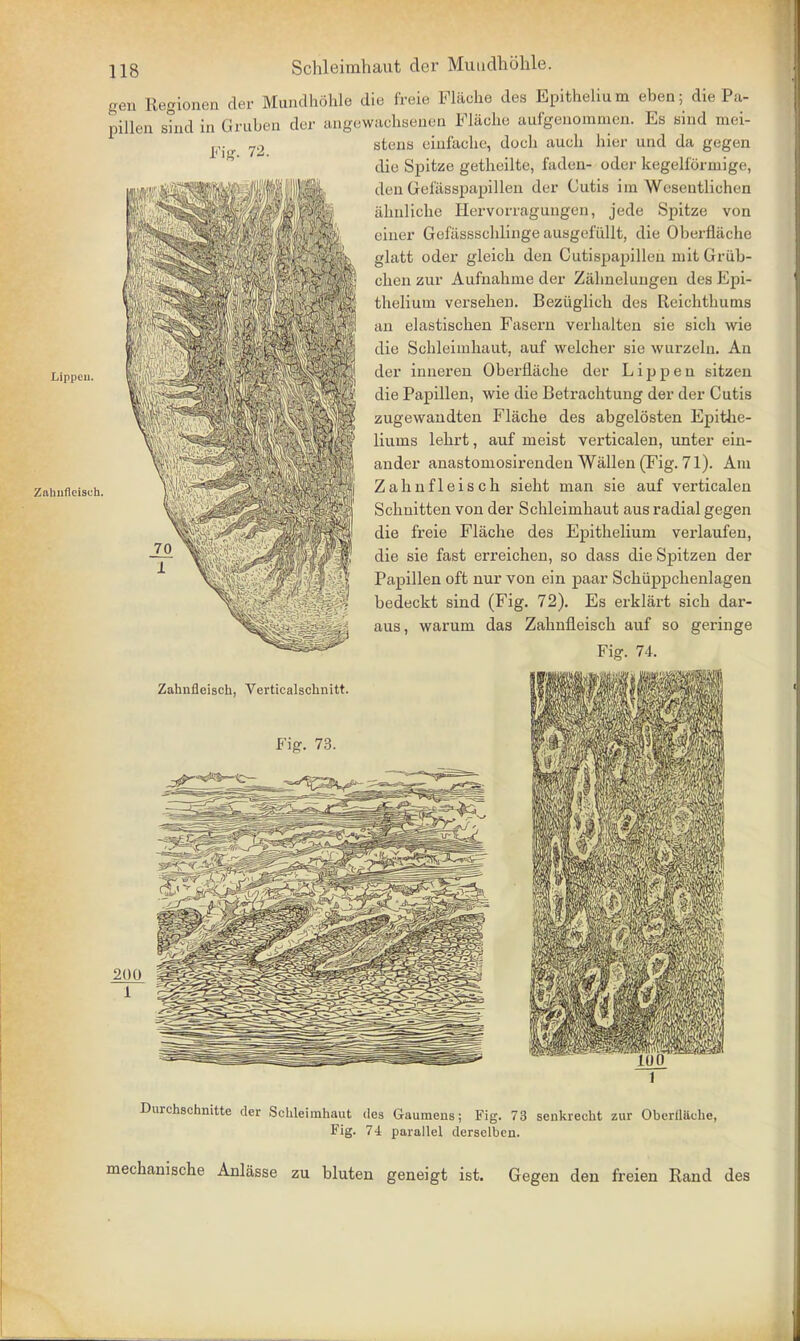 Fig. 72. Lippen. Zahuflcisuh. 118 Schleimhaut der Muudhbhle. gen Regionen der Mundh5hle die freie Flache des Epithelium eben; die Pa- pillen sind in Gruben der angewachsenen Flache aufgenommen. Es bind moi- stens einfache, doch auch liier und da gegen die Spitze getheilte, faden- oder kegelforinige, den Gehisspapillen der Cutis im Wesentliehen ahnliche Hervorragungen, jede Spitze von einer Gefiissschlinge ausgefullt, die Oberflache glatt oder gleich den Cutispapilleh niit Griib- cben zur Aufnahme der Zalinelungen des Epi- thelium versehen. Beziiglich des Reiehthums an elastischen Fasern verhalten sie sich wie die Schleimhaut, auf welcher sie wurzelu. An der inneren Oberfliiche der Lippen sitzen die Papillen, wie die Betrachtung der der Cutis zugewandten Flache des abgelosten Epithe- liums lehrt, auf meist verticalen, unter ein- ander anastomosirenden Wallen (Fig. 71). Am Zahnfleisch sieht man sie auf verticalen Schnitten von der Schleimhaut aus radial gegen die freie Flache des Epithelium verlaufen, die sie fast erreichen, so dass die Spitzen der Papillen oft nur von ein paar Schiippchenlagen bedeckt sind (Fig. 72). Es erklart sich dar- aus, warum das Zahnfleisch auf so geringe Fig. 74. Zahnfleisch, Verticalschnitt. Fig. 73. 200 100 1 Durchschnitte der Schleimhaut des Gaumeus; Fig. 73 senkrecht zur Oberflache, Fig. 74 parallel dersclbcn. mechanische Anlasse zu bluten geneigt ist. Gegen den freien Rand des