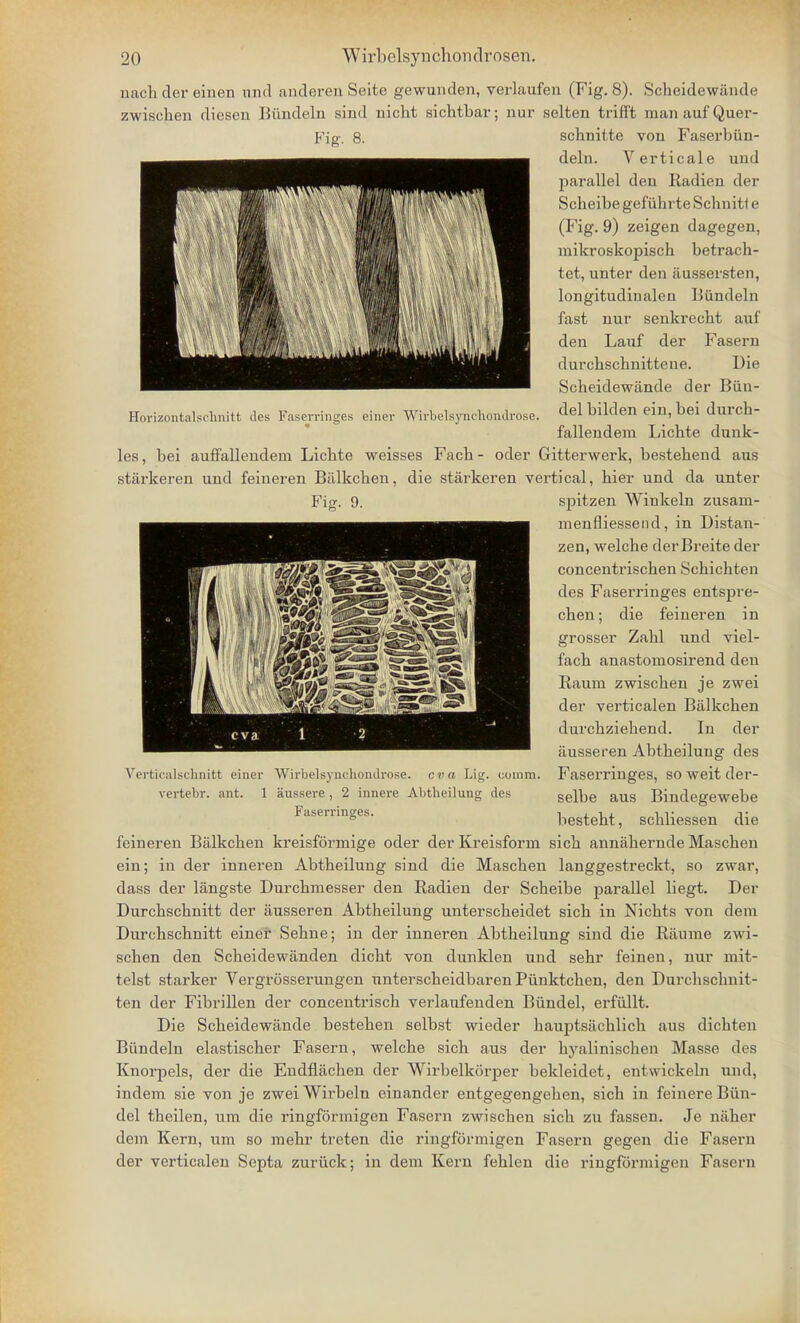 Horizontalschnitt des Faserringes einer Wirbels)rnchondrose. nackdereinen unci anderenSeite gewunden, verlaufen (Fig. 8). Sckeidewande zwiscken diesen Biindeln siiid nicht siehtbar; nur selten trifft manaufQuer- Kig-. 8. scknitte von Faserbiin- deln. Verticale und parallel den Radien der Scbeibe gef iihrte Scknitl e (Fig. 9) zeigen dagegen, mikroskopisch betraek- tet, unter den aussersten, longitudinalen Biindeln fast nur senkreckt auf den Lauf der Fasern durckscknittene. Die Sckeidewande der Biin- del bilden ein, bei durck- fallendem Lickte dunk- les, bei auffallendem Licbte weisses Facb - oder Gitterwerk, bestebend aus starkeren und feineren Biilkcken, die starkeren vertical, kier und da unter Fig. 9. spitzen Winkeln zusain- menfliessend, in Distan- zen, welcke derBreite der concentriscken Sckickten des Faserringes entspre- cken; die feineren in grosser Zakl und viel- fack anastomosirend den Rauna zwiscken je zwei der verticalen Biilkcken durckziekend. In der itusseren Abtbeilung des Faserringes, so weit der- selbe aus Bindegewebe besteht, scbliessen die feineren Balkcken kreisformige oder der Kreisforni sick annakernde Mascken ein; in der inneren Abtbeilung sind die Mascken langgestreckt, so zwar, dass der langste Durckmesser den Radien der Sckeibe parallel liegt. Der Durckscknitt der ausseren Abtbeilung untersckeidet sick in Nickts von dem Durckscknitt einer Sekne; in der inneren Abtbeilung sind die Raume zwi- scken den Sckeidewanden dickt von dunklen und sekr feinen, nur mit- telst starker Vergrosserungen nntersckeidbaren Piinktcken, den Durckscknit- ten der Fibrillen der concentriscb verlaiifenden Biindel, erfiillt. Die Sckeidewande besteken selbst wieder bauptsacklick aus dickten Biindeln elastiscker Fasern, welcke sick aus der kyaliniscken Masse des Knorpels, der die Endfiacken der Wirbelkorper bekleidet, entwickeln und, indem sie von je zwei Wirbeln einander entgegengeben, sick in feinere Biin- del tkeilen, um die ringforinigen Fasern zwiscken sick zu fassen. Je naker dem Kern, um so mekr treten die ringformigen Fasern gegen die Fasern der verticalen Septa zuriick; in dem Kern feklcn die ringformigen Fasern Verticalschnitt einer Wirbelsynoliondrose. cva Lig. comm. vertebr. ant. 1 aussere , 2 innere Abtheilung des Faserringes.