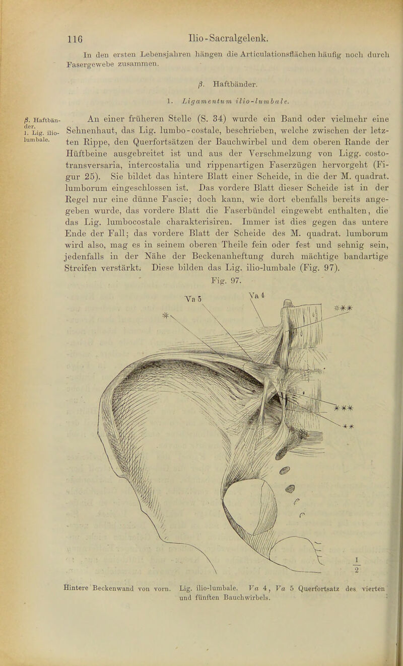 In <len ersten Lebensjaliren hangen dieArtioulationsflachenhaufig aoch durcb Fasergewebe zusammen. /S. Haftbiinder. 1. Ligamentum ilio-lumbale. /S. Haftban- An einer friiheren Stelle (S. 34) wurde ein Band oder vielmehr eine lfliig. Uio- Sebnenbaut, das Lig. lumbo-costale, bescbrieben, welche zwischen der letz- lumbaie. ^eri j^ipp6) <jen Querfortsatzen der Bauchwirbel und dem oberen Rande der Hiiftbeine ausgebreitet ist und aus der Verscbnielzimg von Ligg. costo- transversaria, intercostalia und rippenartigen Faserziigen bervorgebt (Fi- gur 25). Sie bildet das bintere Blatt einer Scbeide, in die der M. quadrat, luniboruni eingescblossen ist. Das vordere Blatt dieser Scbeide ist in der Regel nur eine diinne Fascie; docb kann, wie dort ebenfalls bereits ange- geben wurde, das vordere Blatt die Faserbiindel eingewebt entbalten, die das Lig. lunibocostale cbarakterisiren. Imnier ist dies gegen das untere Ende der Fall; das vordere Blatt der Scbeide des M. quadrat, luniborum wird also, mag es in seinem oberen Tbeile fein oder fest und sebnig sein, jedenfalls in der Nabe der Beckenanbeftung durcb macbtige bandartige Streifen verstarkt. Diese bilden das Lig. ilio-lumbale (Fig. 97). Fig. 97. Hintere Beckenwand von vorn. Lig. ilio-lumbale. Va 4, For 5 Querfortsatz des vierten und funi'ten Baucliwirbels.