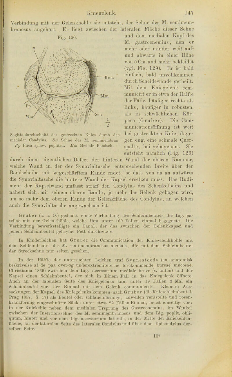 Verbindung mit dev Gelonkhohle sie entsteht, der Sehne des M. semimem- branosus angehort. Er liegt zwisoheri der lateralen Flache dieser Sehne mill dem medialen Kopf des M. gastrocnemius, den er mehr oder minder weit auf- iind abwfirts in einer Ilohe von 5 Cm.und inebr,bekleidet (vgl. Fig. 129). Er ist bald einfach, bald unvollkoinmen durcb ttoheidewiinde getbeilt. Mit dem Kniegelenk com- municirt er in etwa der Halfte der Falle, haufiger recbts als links, haufiger in robusten, als in schwachlichen Kor- pern (Gruber). Die Com- nmnicationsoffhung ist weit Sagittaldurehschnitt des gestreokten Knies durch den bei gestrecktem Knie, dage- medialea Condylus. Sm Sehne des M. semimembran. gen eng, eine scbmale Quer- Pp Plica synov. poplitea. Mm Mediate Bandsch. spalte, bei gebogenem. Sie entstebt namlicb (Fig. 126) (lurch einen eigentlichen Defect der hinteren Wand der oberen Kammer, welche Wand in der der Synovialtasche entsprechenden Breite iiber der Bandscheibe mit zugescharftem Rande endet, so dass von da an aufwarts die Synovialtasche die hintere Wand der Kapsel ersetzen muss. Das Rudi- ment dei- Kapselwand umfasst straff den Condylus des Schenkelbeins und niihert sich. mit seinem oberen Rande, je mehr das Gelenk gebogen wird, um so mehr dem oberen Rande der Gelenkflache des Condylus, an welchen auch die Synovialtasche angewachsen ist. Gruber (a. a. 0.) gedenkt einer Verbindung des Schleimbeutels des Lig. pa- tellae mit der Gelenkhoble, welcbe ibm nnter 160 Fallen einmal begegnete. Die Verbindung bewerkstelligte ein Canal, der das zwiscben der Gelenkkapsel und jenem Scbleinibeutel gelegene Fett durcbsetzte. In Kinderleicben bat Gruber die Communication der Kniegelenkbijble mit dem Scbleinibeutel des M. semimembranosus niemals, die mit dem Scbleimbeutel der Strecksehne nur selten geseben. In der Halfte der untersucbten Leicben traf Synnestoedt (en anatomisk beskrivelse af de paa over-og underextremiteterne forekommende bursae mucosae. Christiania 1869) zwiscben dem Lig. accessorium mediate breve (s. unten) und der Kapsel einen Schleimbeutel, der sicb in Einem Fall in das Kniegeleuk offnete. Auch an der lateralen Seite des Kniegelenks kam unter 19 Fallen 3 Mai ein Bcbleimbeutel vor, der Einmal mit dem Gelenk communicirte. Kleinere Aus- sacknngen der Kapsel des Kniegelenks kommen nach Gruber (dieKniescbleimbeutel. Prag 1857, 8. 17) als Beutel oder scblaucbformige, zuweilen veriistelte und rosen- kranzformig eingeschniirte Siicke unter etwa 22 Fallen Einmal, meist einseitig vor: in der Kniekehle neben dem medialen Ursprung des Gastrocnemius, im Winkel zwischen der Insertionssehne des M. semimembranosus und dem Lig. poplit. obli- (|iium, hinter und vor dem Lig. accessorium laterale, in der Mitte der Kniekehlen- fliicbe, an der lateralen Seite des lateralen Condylus und iiber dem Epicondylus der- selben Seite. in