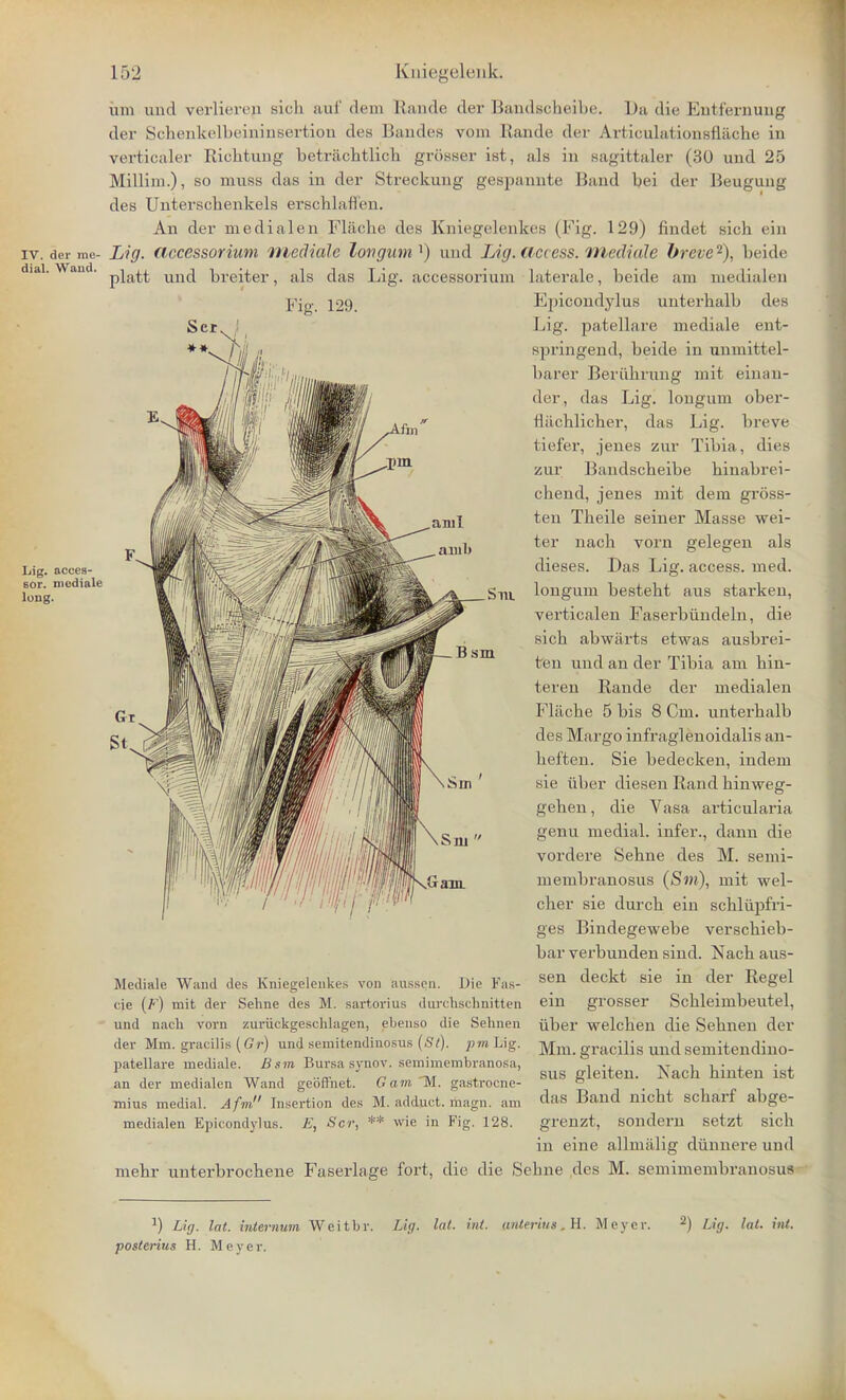 IV. der me- dial. Wand. Lig. acees- sor. mediale long. inn und verlierep sich auf dem Rande der Bandscheibe. Da die Entfernung der Scbenkelbeininsertion des Baudes vom Rande der Articulationsfiache in verticaler Riebtung betrjichtlich grosser ist, als in sagittaler (30 und 25 Millini.), so muss das in der Streckung gespannte Band bei der Beugung des Unterscbenkels erschlafl'en. An der medialen Flacbe des Kniegelenkes (Fig. 129) findet sicb ein Lig. accessorium mediate longumx) und Lit/, access, mediate breve2), beide platt und breiter, als das Lig. accessorium laterale, beide am medialen Fig. 129. Epicondylus uuterbalb (Its Lig. patellare mediale ent- springend, beide in unmittel- barer Beriibrung mit einan- der., das Lig. longuni ober- niichlicher, das Lig. breve tiefer, jenes zur Tibia , dies zur Bandscheibe binabrei- chend, jenes mit dem gross- ten Theile seiner Masse wei- ter nach vorn gelegen als dieses. Das Lig. access, med. Sin. longum besteht aus starken, verticalen Faserbiindeln, die sicb abwiirts etwas ausbrei- ten und an der Tibia am bin- teren Rande der medialen Flacbe 5 bis 8 Cm. unterhalb des Margo infraglenoidalis an- beften. Sie bedecken, indem sie iiber diesen Rand binweg- geben, die Vasa articularia genu medial, infer., dann die vordere Sehne des M. semi- membranosus (Sw), mit wel- cher sie durcb ein schliipfri- ges Bindegewebe verschieb- bar verbunden sind. Nach aus- sen deckt sie in der Regel ein grosser Scbleimbeutel, iiber welcben die Sebnen der Mm. gracilis und semitendino- sus gleiten. Nach hinten ist das Band nicht scharf abge- grenzt, sondern setzt sich in eine allmalig diinnere und mehr unterbrochene Faserlage fort, die die Sehne des M. semimembranosus sm Mediale Wand des Kniegelenkes von aussen. Die Fas- cie (F) mit der Sehne des M. sartorius durchschnitten und nach vorn zuriickgeschlagen, ebenso die Sehnen der Mm. gracilis (Gr) und semitendiuosus (St), pmlfig. patellare mediale. Bsm Bursasynor. semimembranoSa, an der medialen Wand geoffnet. Gam M. gastrocne- mius medial. Afm Insertion des M. addjict. magn. am medialen Epicondylus. E, Scr, ** wie in Fig. 128. :) Lig. lat. internum Weitbr. Lig. Int. hd. anteriut . II. Meyer. 2) Lig. lut. int. posterius H. Meyer.