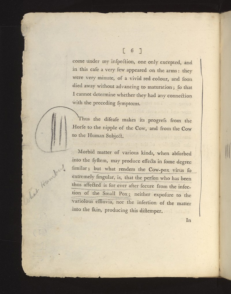 Si** come under my infpe6lion, one only excepted, and in this cafe a very few appeared on the arms: they were very minute, of a vivid red colour, and foon died away without advancing to maturation; fo that I cannot determine whether they had any conneftion with the preceding fymptoms. hus the difeafe makes its progrefs from the Horfe to the nipple of the Cow, and from the Cow to the Human Subje6l. Morbid matter of various kinds, when abforbed into the fyftem, may produce elfeas in fome degree fimilar; but what renders the Cow-pox virus fo extremely fmgular, is, that the perfon who has been thus aflFefled is for ever after fecure from the infec- ^J^ either expoilirelo the variolous effluvia,' nor the infertion of the matter into the Ikin, producing this diftemper. In