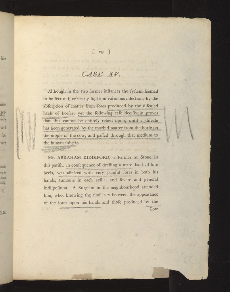 CASE XV, Although in the two former inftances the fyflem Teemed to be fecured^ or nearly fo, from variolous infeftion, by the abforption of matter from fores produced by the difcafed | heels of horfes, yet the following cafe decifively proves f that this cannot be entirely relied upon/ until , a difeafe ^ f has been venerated by the morbid matter from, the horfe on^^ the nipple of the cow, and pafTed through that medium to the humati fubje6l. Mr. ABRAHAM RIDDIFORD, a Farmer at Stone in this parifli, in confequence of dreffing a naare that had fore heels, was affefted with very painful fores in both his hands, tumours in each axilla, and fevere and general indifpofition. A Surgeon in the neighbourhood attended him, who, knowing the fimilarity between the appearance of the fores upon his hands and thofe produced by the