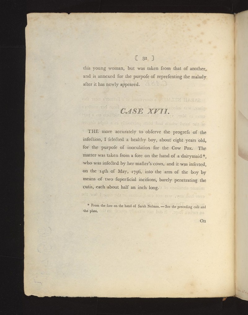 C 3^ 3 tHis young woman, but was taken from that of another, and is annexed for the purpofe of reprefenting the malad|r after it has newly appeared, €J.SE XVII. THE more accurately to obferve the progrefs of the infeftion, I felefted a healthy boy, about eight years old, for the purpofe of inoculation for the Cow Pox. The matter was taken from a fore on the hand of a dairymaid*, who was infefted by her mafter's cows, and it was inferted, on the 14th of May, 1796, into the arm of the boy by means of two fuperficial incifions, barely penetrating the cutis, each about half an inch long. * From the fore on the hand of Sarah Nelmes. — See the preceding cafe and the plate. On