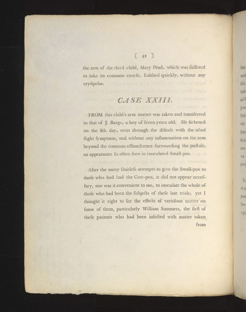 the arm of the third child, Mary Pead, which was fufFered to take its common courfe, fcabbed quickly, without any eryfipelas. CASE XXIII. FROM this child's arm matter was taken and transferred to that of J. Barge, a boy of feven years old. He fickened on the 8th day, went through the difeafe with the ufual flight fymptoms, and without any inflammation on the arm beyond the common efflorefcence furrounding the pufl:ule, an appearance fo often feen in inoculated Small-pox. After the many fruitlefs attempts to give the Small-pox to thofe who had had the Cow-pox, it did not appear necef- fary, nor was it convenient to me, to inoculate the w^hole of thofe who had been the fubjefts of thefe late trials; yet I thought it right to fee the efFefts of variolous matter on fome of them, particularly William Summers, the firfl: of thefe patients who had been infefted with matter taken from