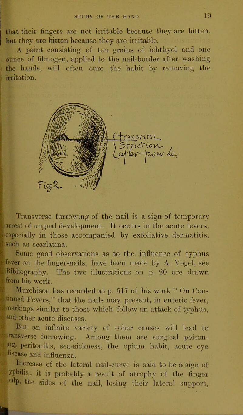 that their fingers are not irritable because they are bitten, but they are bitten because they are irritable. A paint consisting of ten grains of ichthyol and one ounce of fi Imogen, applied to the nail-border after washing the hands, will often cure the habit by removing the irritation. Transverse furrowing of the nail is a sign of temporary arrest of ungual development. It occurs in the acute fevers, especially in those accompanied by exfoliative dermatitis, such as scarlatina. Borne good observations as to the influence of typhus ; fever on the finger-nails, have been made by A. Vogel, see Bibliography. The two illustrations on p. 20 are drawn from his work. I Murchison has recorded at p. 517 of his work “ On Con- tinued Fevers,” that the nails may present, in enteric fever, narkings similar to those which follow an attack of typhus, lnd other acute diseases. But an infinite variety of other causes will lead to ransverse furrowing. Among them are stirgical poison- I ng, peritonitis, sea-sickness, the opium habit, acute eye \ lisease and influenza. Increase of the lateral nail-curve is said to be a sign of i yphilis; it is probably a result of atrophy of the finger mlp, the sides of the nail, losing their lateral support,