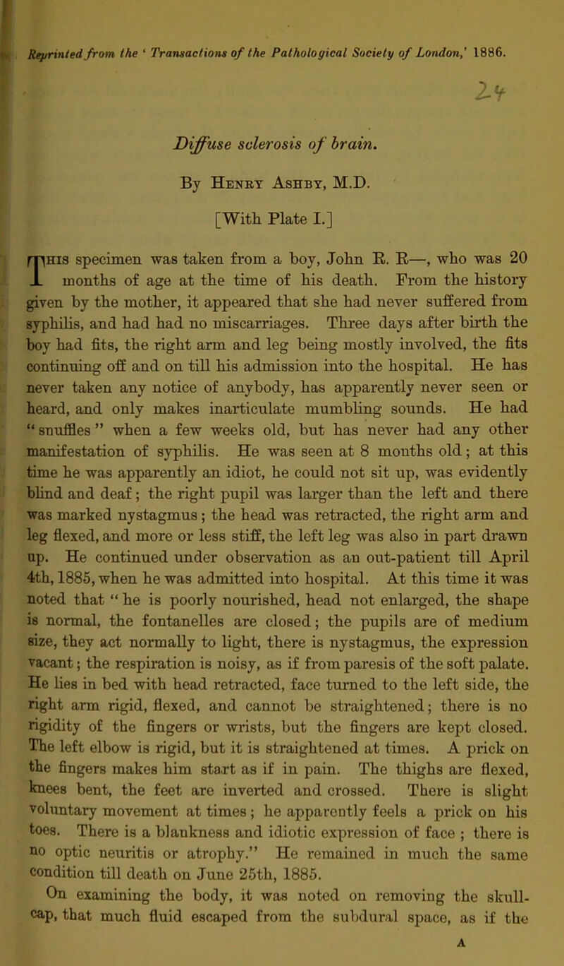 Reprinted from the ' Transactions of the Pathological Society of London,' 1886. Diffuse sclerosis of brain. By Henry Ashby, M.D. [With Plate L] This specimen was taken from a boy, John E. R—, who was 20 months of age at the time of his death. From the history given by the mother, it appeared that she had never suffered from syphilis, and had had no miscarriages. Three days after birth the boy had fits, the t*ight arm and leg being mostly involved, the fits continuing off and on till his admission into the hospital. He has never taken any notice of anybody, has apparently never seen or heard, and only makes inarticulate mumbling sounds. He had  snuffles  when a few weeks old, but has never had any other manifestation of syphilis. He was seen at 8 months old; at this time he was apparently an idiot, he could not sit up, was evidently bhnd and deaf; the right pupil was larger than the left and there was marked nystagmus; the head was retracted, the right arm and leg flexed, and more or less stiff, the left leg was also in part drawn up. He continued under observation as an out-patient till April 4th, 1885, when he was admitted into hospital. At this time it was noted that  he is poorly nourished, head not enlarged, the shape is normal, the fontanelles are closed; the pupils are of medium size, they act normally to light, there is nystagmus, the expression vacant; the respiration is noisy, as if from paresis of the soft palate. He lies in bed with head retracted, face turned to the left side, the right arm rigid, flexed, and cannot be straightened; there is no rigidity of the fingers or wrists, but the fingers are kept closed. The left elbow is rigid, but it is straightened at times. A prick on the fingers makes him start as if in pain. The thighs are flexed, knees bent, the feet are inverted and crossed. There is slight voluntary movement at times; he apparently feels a prick on his toes. There is a blankness and idiotic expression of face ; there is no optic neuritis or atrophy. He remained in much the same condition till death on June 25th, 1885. On examining the body, it was noted on removing the skull- cap, that much fluid escaped from the subdural space, as if the A