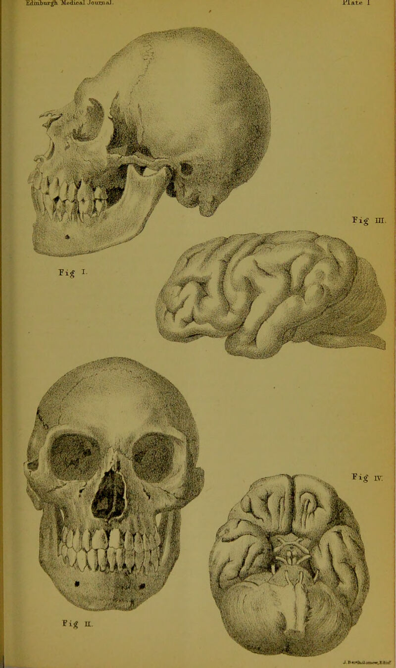 Fig II. 1 iv; Fig m. J. I'nrOuUanMiw, Kdmv