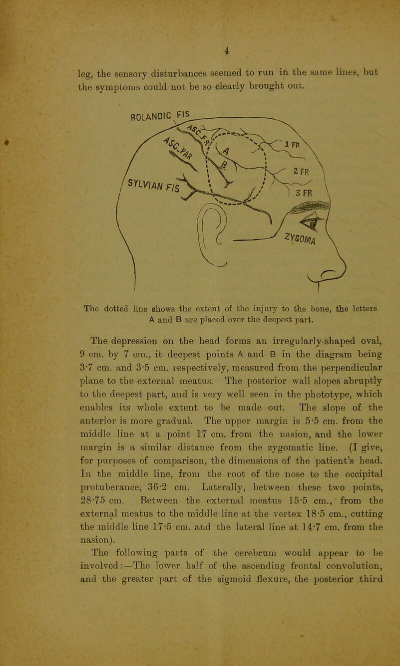 leg, the sensory disturbances seemed to run in the same lines, but the symptoms could not be so clearly brought out. # The dotted line shows the extent of the injury to the bone, the letters A and B are placed over the deepest part. The depression on the head forms an irregularly-shaped oval, 9 cm. by 7 cm., it deepest points A and B in the diagram being 3*7 cm. and 3-5 cm. respectively, measured from the perpendicular plane to the external meatus. The posterior wall slopes abruptly to the deepest part, and is very well seen in the phototype, which enables its whole extent to be made out. The slope of the anterior is more gradual. The upper margin is 5-5 cm. from the middle line at a point 17 cm. from the nasion, and the lower margin is a similar distance from the zygomatic line. (I give, for purposes of comparison, the dimensions of the patient's head. In the middle line, from the root of the nose to the occipital protuberance, 36'2 cm. Laterally, between these two points, 2875 cm. Between the external meatus 15*5 cm., from the external meatus to the middle line at the vertex 18*5 cm., cutting the middle line 17*5 cm. and the lateral line at 14*7 cm. from the nasion). The following parts of the cerebrum would appear to be involved:—The lower half of the ascending frontal convolution, and the greater part of the sigmoid flexure, the posterior third