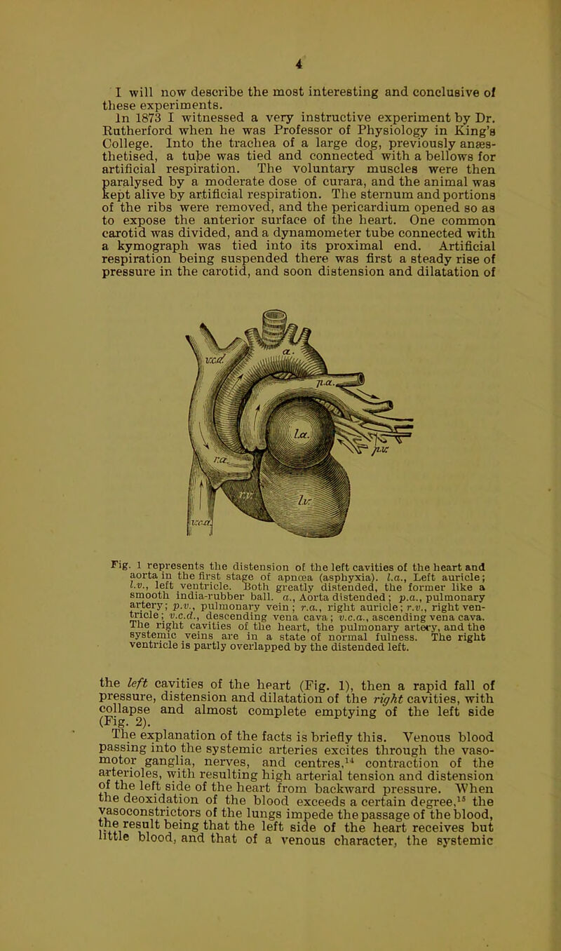 I will now describe the most interesting and conclusive ol these experiments. In 1873 I witnessed a very instructive experiment by Dr. Rutherford when he was Professor of Physiology in King’s College. Into the trachea of a large dog, previously anaes- thetised, a tube was tied and connected with a bellows for artificial respiration. The voluntary muscles were then paralysed by a moderate dose of curara, and the animal was kept alive by artificial respiration. The sternum and portions of the ribs were removed, and the pericardium opened so as to expose the anterior surface of the heart. One common carotid was divided, and a dynamometer tube connected with a kymograph was tied into its proximal end. Artificial respiration being suspended there was first a steady rise of pressure in the carotid, and soon distension and dilatation of Fig. l represents the distension of the left cavities of the heart and aorta in the first stage of apncea (asphyxia), l.a., Left auricle; l.v., left ventricle. Both greatly distended, the former like a smooth india-rubber ball, a., Aorta distended ; p.a., pulmonary artery; p.v., pulmonary vein; r.a., right auricle; r.v., rightven- tncle; v.c.d., descending vena cava; v.c. a., ascending vena cava. The right cavities of the heart, the pulmonary artery, and the systemic veins are in a state of normal fulness. The right ventricle is partly overlapped by the distended left. the left cavities of the heart (Fig. 1), then a rapid fall of pressure, distension and dilatation of the right cavities, with collapse and almost complete emptying of the left side (Fig. 2). The explanation of the facts is briefly this. Venous blood passing into the systemic arteries excites through the vaso- motor ganglia, nerves, and centres,11 contraction of the artenoles, with resulting high arterial tension and distension of the left side of the heart from backward pressure. When the deoxidation of the blood exceeds a certain degree,15 the vasoconstrictors of the lungs impede the passage of the blood, the result being that the left side of the heart receives but little blood, and that of a venous character, the systemic