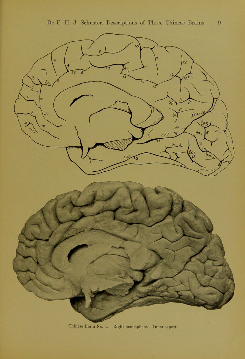 Chinese Brain No. 1. Right hemisphere. Inner aspect.