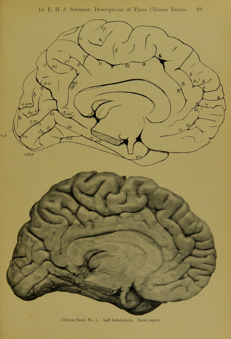 nv Chinese Brain No. 1. Left hemisphere. Inner aspect.