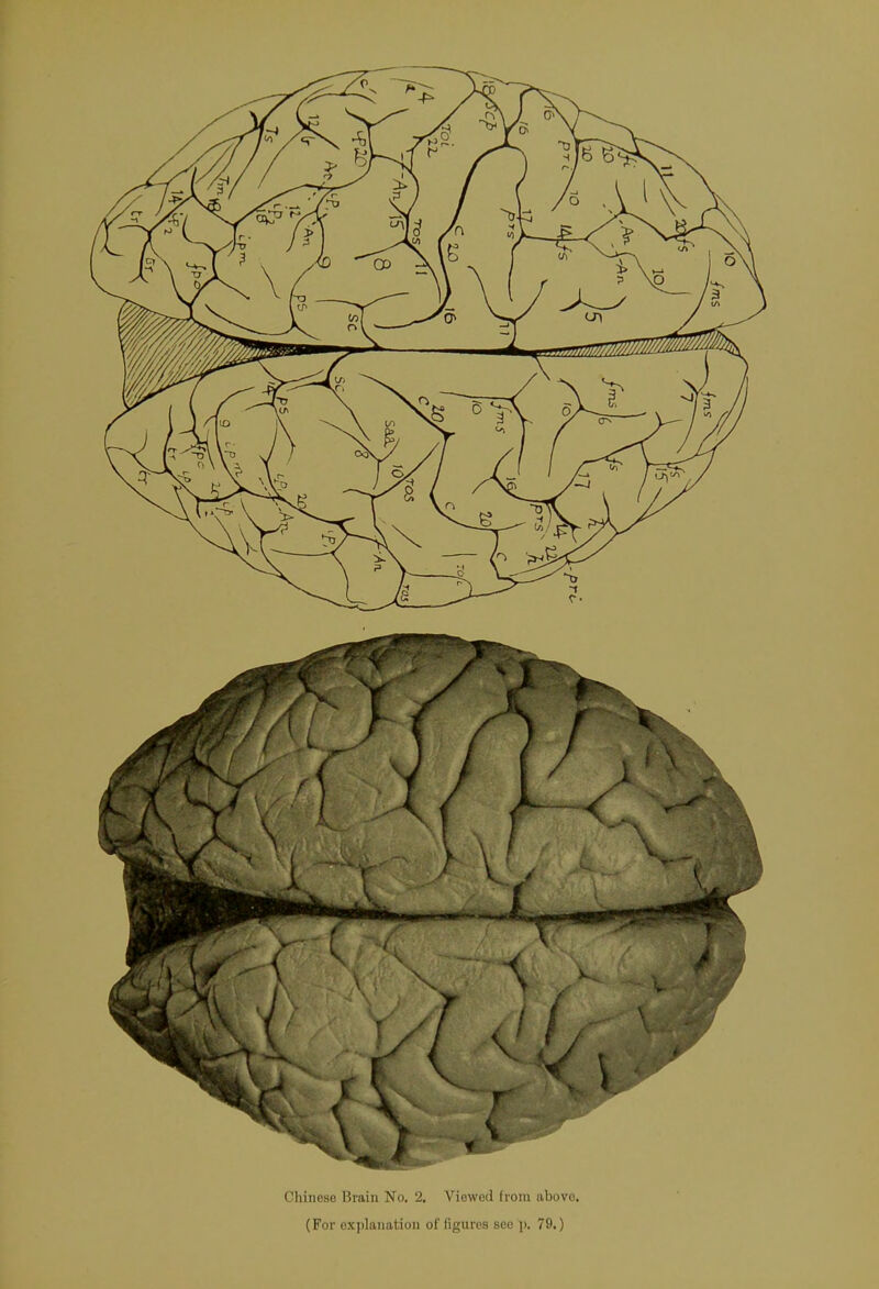 Chinese Brain No. 2. Viewed from above. (For explanation of figures see p. 79.)