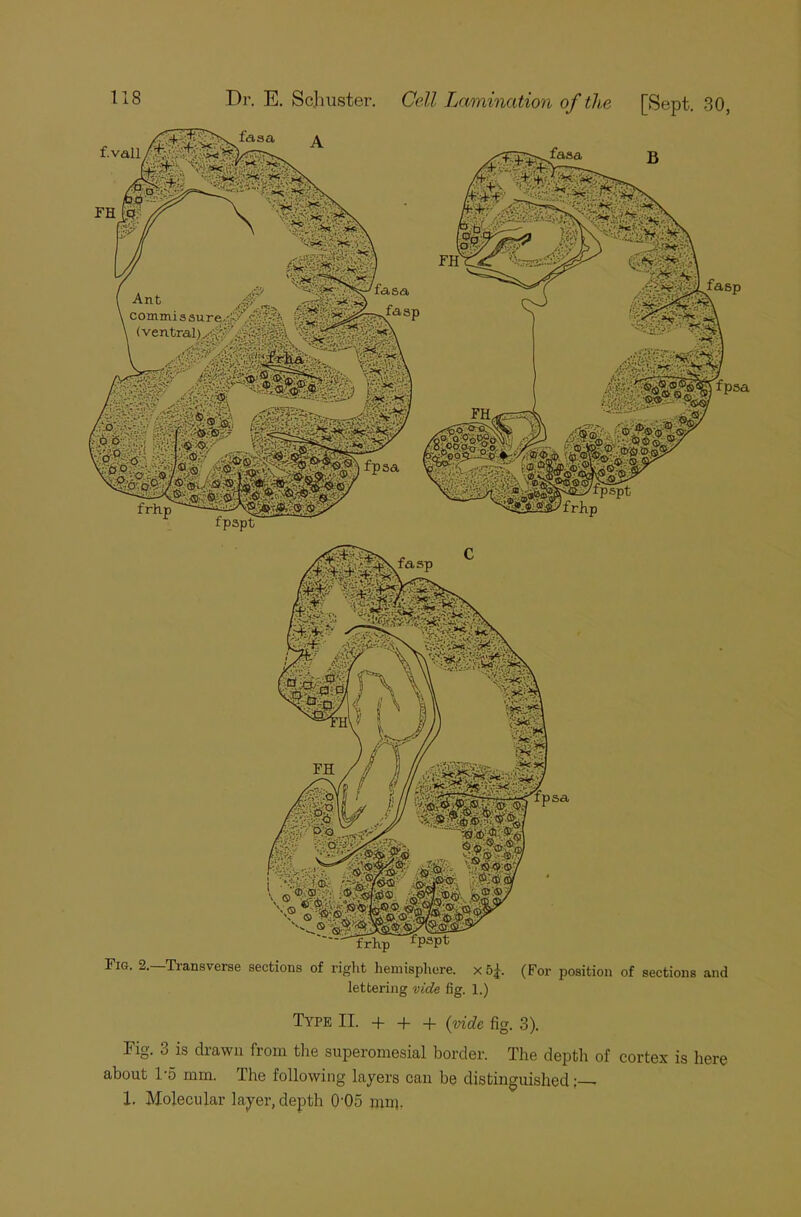 Fig. 2. Transverse sections of right hemisphere, x 5£. (For position of sections and lettering vide fig. 1.) Type II. + + + (vide fig. 3). Tig. 3 is drawn from the superomesial border. The depth of cortex is here about 1-5 mm. The following layers can be distinguished:— X. Molecular layer, depth 0'05 mi)].