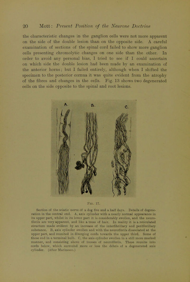 the characteristic changes in the ganglion cells were not more apparent on the side of the double lesion than on the opposite side. A careful examination of sections of the spinal cord failed to show more ganglion cells presenting chromolytic changes on one side than the other. In order to avoid any personal bias, I tried to see if I could ascertain on which side the double lesion had been made by an examination of the anterior horns; but I failed entirely, although when I shifted the specimen to the posterior cornua it was quite evident from the atrophy of the fibres and changes in the cells. Fig. 13 shows two degenerated cells on the side opposite to the spinal and root lesions. Fig. 17. Section of the sciatic nerve of a dog five and a half days. Details of degene- ration in the central end. A, axis cylinder with a nearly normal appearance in its upper part, whilst in its lower part it is considerably swollen, and the neuro- fibrils are very apparent, and like a tress of hair. In reality it is a reticulated structure made evident by an increase of the interfibrillary and perifibrillary substance. B, axis cylinder swollen and with the neurofibrils dissociated at the upper part, and reunited in diverging cords towards the upper third. Some of these end in a terminal bulb. C, the axis cylinder swollen in a still more marked manner, and consisting above of tresses of neurofibrils. These reunite into cords below, which surround more or less the ddbris of a degenerated axis cylinder. (After Marinesco.)