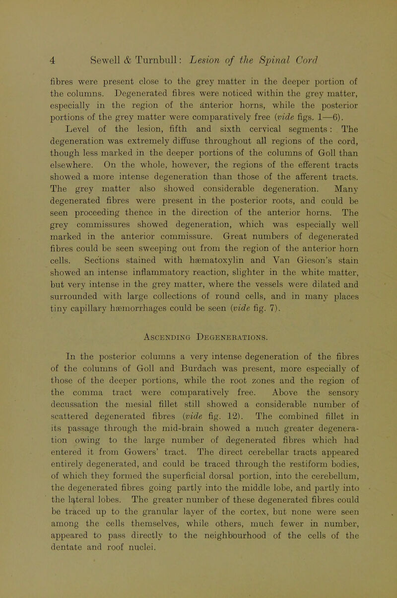 fibres were present close to the grey matter in the deeper portion of the columns. Degenerated fibres were noticed within the grey matter, especially in the region of the anterior horns, while the posterior portions of the grey matter were comparatively free {vide figs. 1—6). Level of the lesion, fifth and sixth cervical segments: The degeneration was extremely diffuse throughout all regions of the cord, though less marked in the deeper portions of the columns of Goll than elsewhere. On the whole, however, the regions of the efferent tracts showed a more intense degeneration than those of the afferent tracts. The grey matter also showed considerable degeneration. Many degenerated fibres were present in the posterior roots, and could be seen proceeding thence in the direction of the anterior horns. The grey commissures showed degeneration, which was especially well marked in the anterior commissure. Great numbers of degenerated fibres could be seen sweeping out from the region of the anterior horn cells. Sections stained with hsematoxylin and Van Gieson’s stain showed an intense inflammatory reaction, slighter in the white matter, but very intense in the grey matter, where the vessels were dilated and surrounded with large collections of round cells, and in many places tiny capillary haemorrhages could be seen {vide fig. 7). Ascending Degenerations. In the posterior columns a very intense degeneration of the fibres of the columns of Goll and Burdach was present, more especially of those of the deeper portions, while the root zones and the region of the comma tract were comparatively free. Above the sensory decussation the mesial fillet still showed a considerable number of scattered degenerated fibres {vide fig. 12). The combined fillet in its passage through the mid-brain showed a much greater degenera- tion owing to the large number of degenerated fibres which had entered it from Gowers’ tract. The direct cerebellar tracts appeared entirely degenerated, and could be traced through the restiform bodies, of which they formed the superficial dorsal portion, into the cerebellum, the degenerated fibres going partly into the middle lobe, and partly into the lateral lobes. The greater number of these degenerated fibres could be traced up to the granular layer of the cortex, but none were seen among the cells themselves, while others, much fewer in number, appeared to pass directly to the neighbourhood of the cells of the dentate and roof nuclei.