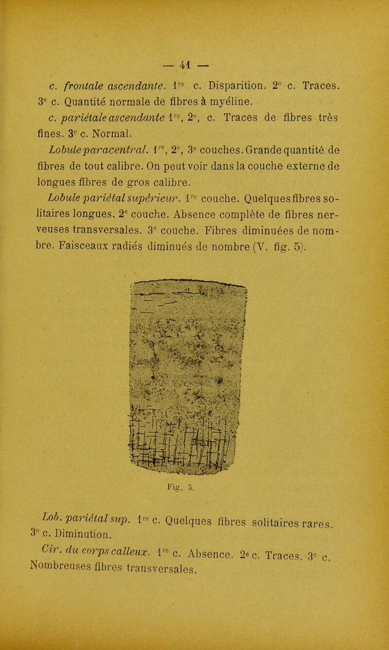 c. frontale ascendante. l’° c. Disparition. 2e c. Traces. 3° c. Quantité normale de fibres à myéline. c. pariétale ascendante lro, 2°, c. Traces de fibres très fines. 3e c. Normal. Lobuleparacentrai. lre, 2°, 3° couches. Grande quantité de fibres de tout calibre. On peut voir dans la couche externe de longues fibres de gros calibre. Lobule pariétal supérieur. lro couche. Quelquesfibres so- litaires longues. 2° couche. Absence complète de fibres ner- veuses transversales. 3e couche. Fibres diminuées de nom- bre. Faisceaux radiés diminués de nombre (V. fig. 5). Fig. s. Lob. pariétalsup. I1'0 c. Quelques fibres solitaires rares. 3° c. Diminution. Cir. du corps calleux. lro c. Absence. 2«c. Traces. 3e c. Nombreuses fibres transversales,