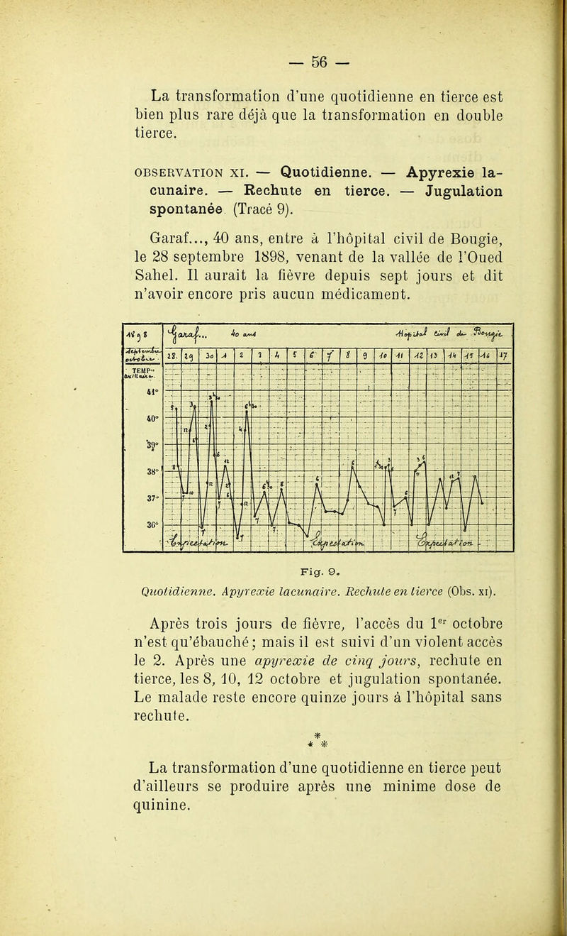 La transformation d’une quotidienne en tierce est bien plus rare deja que la transformation en double tierce. observation xi. — Quotidienne. — Apyrexie la- cunaire. — Rechute en tierce. — Jugulation spontanea (Trace 9). Garaf..., 40 ans, entre a l’hopital civil de Bougie, le 28 septembre 1898, venant de la vallee de 1’Oued Sahel. II aurait la fievre depuis sept jours et dit n’avoir encore pris aucun medicament. 3 8 it. *9 3 o A 2 *3 ti t 6' i t 9 jo Ai o Ai J7 TEMP- Clh'IIujai-- 41° 40° -3T 38° 1 37° 30° : 4° “4. 4- 4 ■ ; * y. - ■r e :z\. -- 5: It i *■ k ..... yr; ; £ . M 6 • r\ 4:: l.v.. ’ 6 ' U; m V * A _« e i' ill 4 4 . '4- f n J V 4 ('• J r\ y V 1 | ' : 0 pm W T~ A fi* 'cX-i ml 4; 844.: y K/ia. on- Fig. 9. Quotidienne. Apyrexie lacunaire. Rechute en tierce (Obs. xr). Apres trois jours de fievre, faeces du ler octobre n’est qu’ebauche; maisil est suivi d’un violent acces le 2. Apres une apyrexie de cinq jours, rechute en tierce, les 8, 10, 12 octobre et jugulation spontanee. Le malade reste encore quinze jours a l’hopital sans rechute. * La transformation d’une quotidienne en tierce peut d’ailleurs se produire apres une minime dose de quinine.