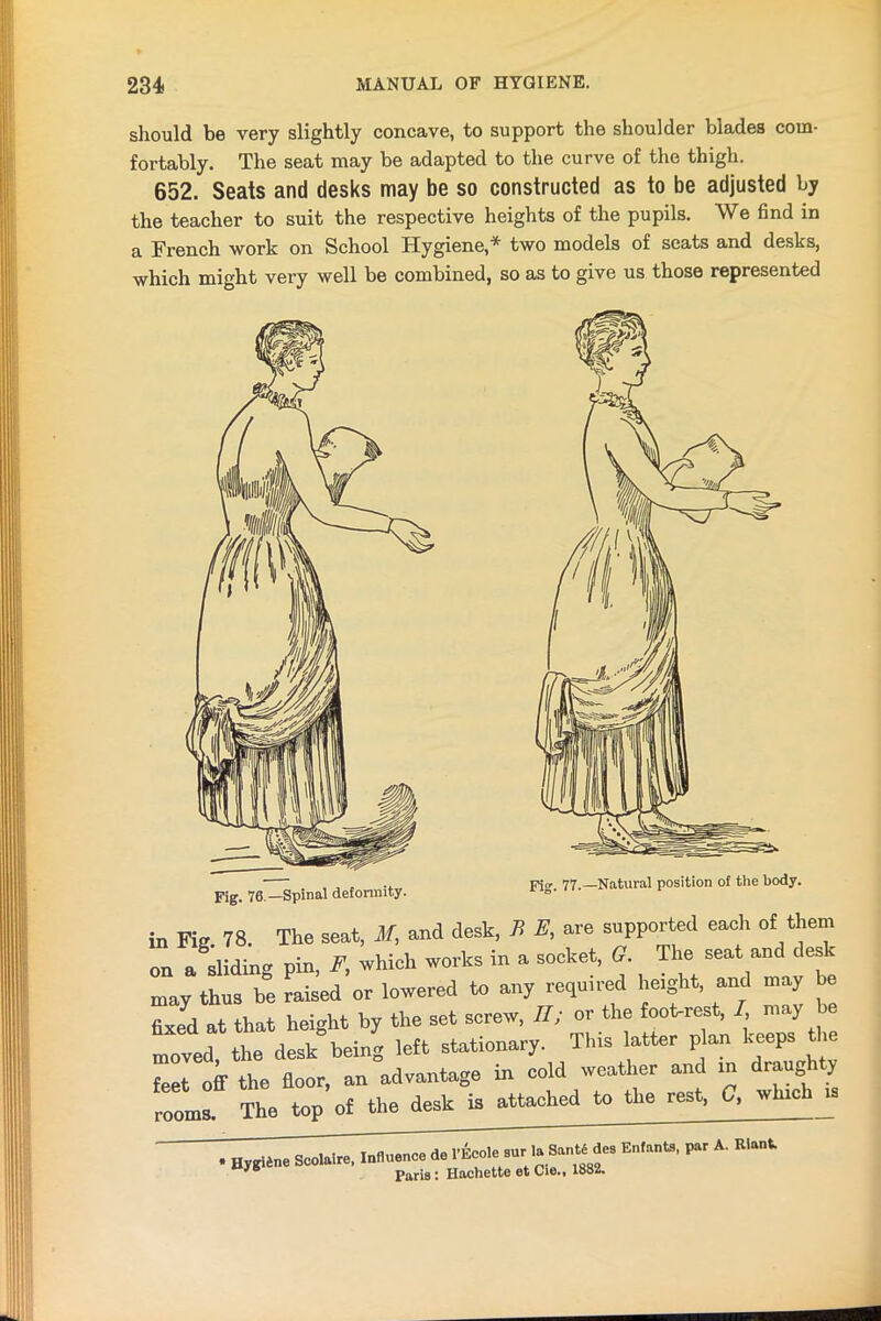 should be very slightly concave, to support the shoulder blades com- fortably. The seat may be adapted to the curve of the thigh. 652. Seats and desks may be so constructed as to be adjusted by the teacher to suit the respective heights of the pupils. We find in a French work on School Hygiene,* two models of seats and desks, which might very well be combined, so as to give us those represented Fig. 76.—Spinal deformity. in Fig 78. The seat, M, and desk, B E, are supported each of them on a ^sliding pin, F, which works in a socket, G. The seat and desk may thus be raised or lowered to any required height, and may be fixed at that height by the set screw, II; or the fookrest, I may moved, the desk being left stationary. This latter plan keeps ie feet off the floor, an advantage in cold weather and in draughty The top of the desk is attached to the rest, G, winches rooms.