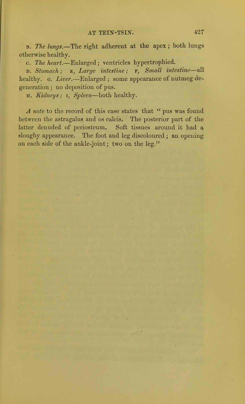 B. The lungs.—The right adherent at the apex; both lungs otherwise healthy. c. The heart.—Enlarged; ventricles hypertrophied. D. Stomach ; Large intestine; t, Small intestine—all healthy, g. Liver.—Enlarged; some appearance of nutmeg de- generation ; no deposition of pus. H. Kidneys; i, Spleen—both healthy. A note to the record of this case states that pus was found between the astragalus and os calcis. The posterior part of the latter denuded of periosteum. Soft tissues around it had a sloughy appearance. The foot and leg discoloured; an opening on each side of the ankle-joint; two on the leg.^^