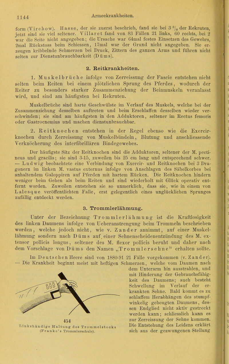 form (V i r c h o w). Hasse, der sie zuerst beschrieb, fand sie bei 3 °/0 der Rekruten, jetzt sind sie viel seltener. Villaret fand von 83 Fällen 21 links, 60 rechts, bei 2 war die Seite nicht angegeben; die Ursache war 64mal festes Einsetzen des Gewehrs, 2mal Rückstoss beim Schiessen, 17mal war der Grund nicht angegeben. Sie er- zeugen kribbelnde Schmerzen bei Druck, Zittern des ganzen Arms und führen nicht selten zur Dienstunbrauchbarkeit (Düms). 2. Reitkrankheiten. 1. Muskelbrücke infolge von Zerreissung der Fascie entstehen nicht selten beim Reiten bei einem plötzlichen Sprung des Pferdes, wodurch der Reiter zn besonders starker Zusammenziehung der Beinmuskeln veranlasst wird, und sind am häufigsten bei Rekruten. Muskelbrüche sind harte Geschwülste im Verlauf des Muskels, welche bei der Zusammenziehung desselben auftreten und beim Erschlaffen desselben wieder ver- schwinden; sie sind am häufigsten in den Adduktoren, seltener im Rectus femoris oder Gastrocnemius und machen dienstunbrauchbar. 2. Reitknochen entstehen in der Regel ebenso wie die Exercir- knocken durch Zerreissung von Muskelbündeln, Blutung und anschliessende Verknöcherung des interfikrillären Bindegewebes. Der häufigste Sitz der Reitknochen sind die Adduktoren, seltener der M. pecti- neus und gracilis; sie sind 3-15, zuweilen bis 25 cm lang und entsprechend schwer. — Ludwig beobachtete eine Verbindung von Exercir- und Reitknochen bei 3 Dra- gonern im linken M. vastus externus infolge von Anschlägen des Säbelkorbes bei anhaltendem Galoppiren auf Pferden mit hartem Rücken. Die Reitknochen hindern weniger beim Gehen als beim Reiten und sind wiederholt mit Glück operativ ent- fernt worden. Zuweilen entstehen sie so unmerklich, dass sie, wie in einem von Lalesque veröffentlichten Falle, erst gelegentlich eines unglücklichen Sprunges zufällig entdeckt werden. 3. Trommlerlähmung. Unter der Bezeichnung Trommlerlähmung ist die Kraftlosigkeit des linken Daumens infolge von Ueberanstrengung beim Trommeln beschrieben worden, welche jedoch nicht, wie v. Zander annimmt, auf einer Muskel- lähmung sondern nach Diims auf. einer Sehnenscheidenentzündung des M. ex- tensor pollicis longus, seltener des M. flexor pollicis beruht und daher nach dem Vorschläge von Diims denNamen „Trommlersehne“ erhalten sollte. Im Deutschen Heere sind von 1880-91 21 Fälle vorgekommen (v. Zander). — Die Krankheit beginnt meist mit heftigen Schmerzen, welche vom Daumen nach dem Unterarm hin ausstrahlen, und mit Hinderung der Gebrauchsfähig- keit des Daumens; auch besteht Schwellung im Verlauf der er- krankten Sehne. Bald kommt es zu schlaffem Herabhängen des stumpf- winkelig gebeugten Daumens, des- sen Endglied nicht aktiv gestreckt werden kann; schliesslich kann es zur Zerreissung der Sehne kommen. Die Entstellung des Leidens erklärt sich aus der gezwungenen Stellung