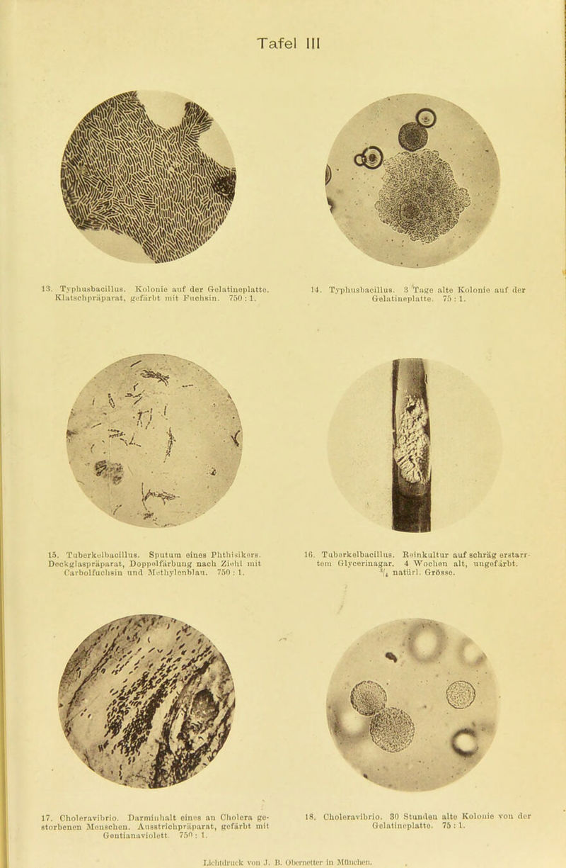 13. T.vpliusbacillus. Kolouie auf der Gelatineplatto. Klatschpräparat, gefärbt mit Fuchsin. 750 : 1. 14. Typhusbaoillus. 3 'Tage alte Kolonie auf der Gelatineplatte. 75 : 1. 15. Tuberkulbacillua. Sputum eines Phthisikers. Deckglaspräparat, Doppolfärbuug nach Ziohl mit Carbolfuchsin und Methylenblau. 750:1. Iß. Tuberkelbacillus. Reinkultur auf BChräg erstarr- tem Glycerinagar. 4 Wochen alt, ungefärbt. 3I4 natiirl. Grösse. 17. Choleravibrio. Darminhalt eines an Cholera ge* 13. Choleravibrio. 30 Stunden alte Kolouie von der storbenen Menschen. Ausstrichpräparat, gefärbt mit Gelatinoplatto. 75 : 1. Geutianaviolett. 750: 1. Lichtdruck von .1. B. Obernetter in München.