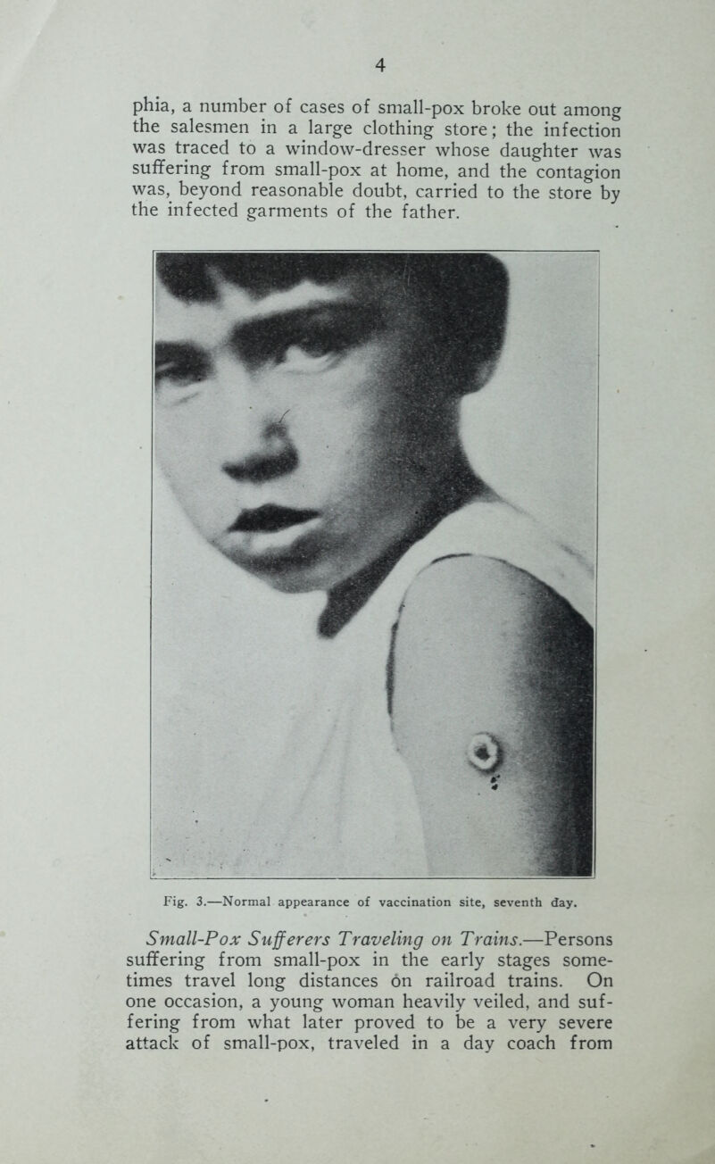 phia, a number of cases of small-pox broke out among the salesmen in a large clothing store; the infection was traced to a window-dresser whose daughter was suffering from small-pox at home, and the contagion was,^ beyond reasonable doubt, carried to the store by the infected garments of the father. Fig. 3.—Normal appearance of vaccination site, seventh day. Small-Pox Sufferers Traveling on Trains.—Persons suffering from small-pox in the early stages some- times travel long distances on railroad trains. On one occasion, a young woman heavily veiled, and suf- fering from what later proved to be a very severe attack of small-pox, traveled in a day coach from