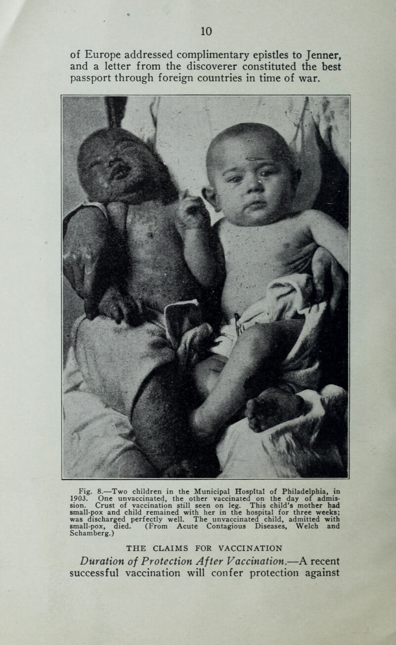 of Europe addressed complimentary epistles to Jenner, and a letter from the discoverer constituted the best passport through foreign countries in time of war. Fig. 8.—Two children in the Municipal Hospital of Philadelphia, in 1903. One unvaccinated, the other vaccinated on the day of admis- sion. Crust of vaccination still seen on leg. This child’s mother had small-pox and child remained with her in the hospital for three weeks; was discharged perfectly well. The unvaccinated child, admitted with small-pox, died. (From Acute Contagious Diseases, Welch and Schamberg.) THE CLAIMS FOR VACCINATION Duration of Protection After Vaccination.—A recent successful vaccination will confer protection against