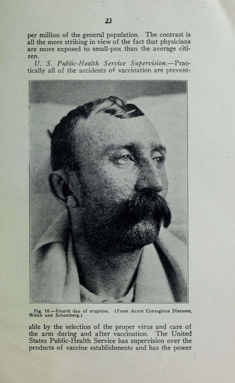 per million of the general population. The contrast is all the more striking in view of the fact that physicians are more exposed to small-pox than the average citi- zen. U. S. Public-Health Service Supervision.—Prac- tically all of the accidents of vaccination are prevent- Fig. 18.—Fourth day of eruption. (From Acute Contagious Diseases, Welch and Schamberg.) able by the selection of the proper virus and care of the arm during and after vaccination. The United States Public-Health Service has supervision over the products of vaccine establishments and has the power