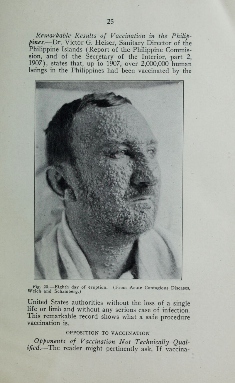Remarkable Results of Vaccination in the Philip- pines.—Dr. Victor G. Heiser, Sanitary Director of the Philippine Islands (Report of the Philippine Commis- sion, and of the Secretary of the Interior, part 2, 1907), states that, up to 1907, over 2,000,000 human beings in the Philippines had been vaccinated by the Fig. 20.—Eighth day of eruption. (From Acute Contagious Diseases. Welch and Schamberg.) United States authorities without the loss of a single life or limb and without any serious case of infection. This remarkable record shows what a safe procedure vaccination is. OPPOSITION TO VACCINATION Opponents of Vaccination Not Technically Qual- ified.—The reader might pertinently ask, If vaccina-