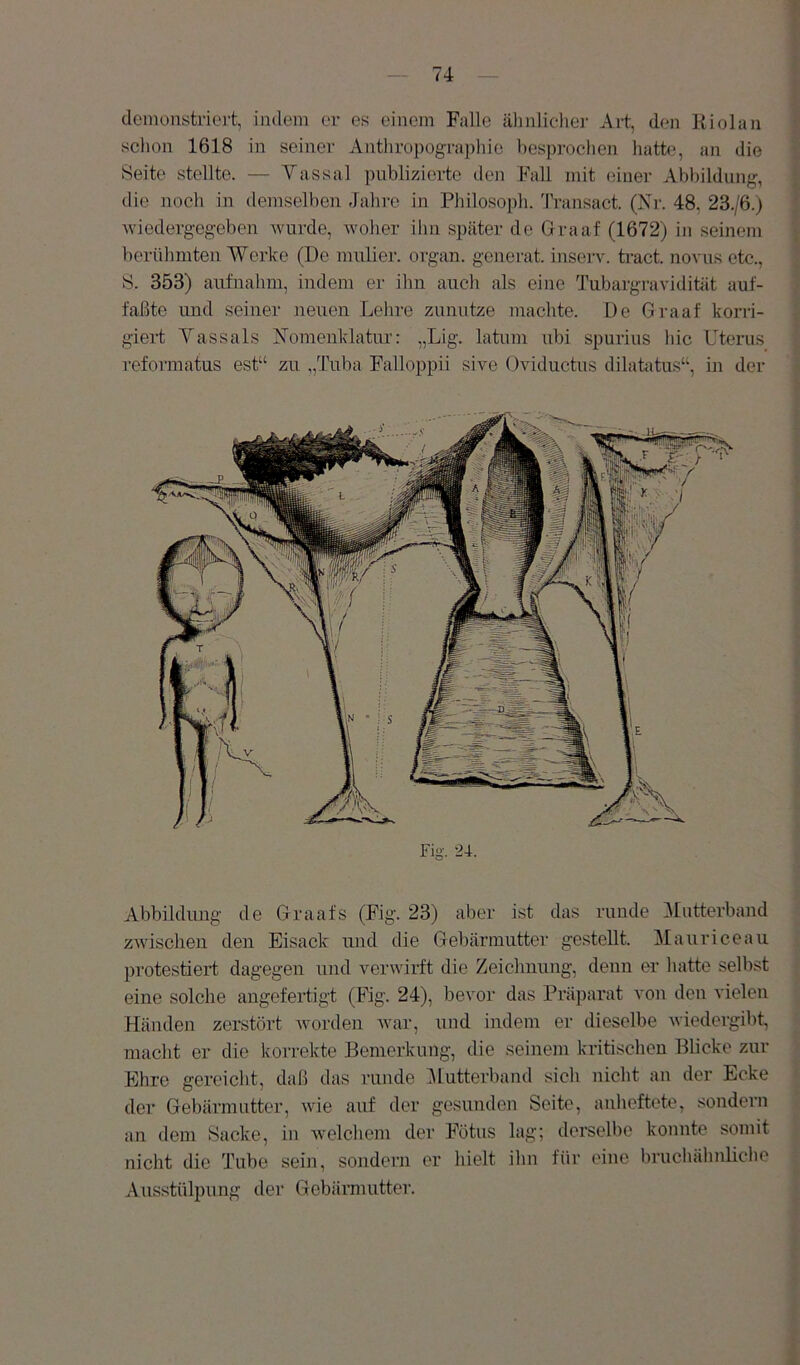 (lemonstriert, indem er es einem Falle ähnlicher Art, den Riol an sclion 1618 in seiner Anthropographie besproclien liatk», an die Seite stellte. — Vassal publizierte den Fall mit einer Abbildung, tlie noch in demselben Jahre in Philosopli. 'IVansact. (Nr. 48, 23./6.) Aviedergegeben Avurde, Avoher ihn später de Graaf (1672) in seinem berühmten Werke (De mulier. organ. generat. inseiT. ti-act. novus etc., S. 353) aufnahm, indem er ihn auch als eine TubargraAudität auf- faßte und seiner neuen Lelire zunutze machte. De Graaf korri- giert Vassais Nomenklatur: „Lig. latum ubi spurius liic Uterus refoT'matus est“ zu „Tuba Falloppii sive Oviductus dilatatus“, in der Fig. 24. Abbildimg de Graafs (Fig. 23) aber ist das runde ^Mutterband zAvischen den Eisack und die Gebärmutter gestellt. Mauriceau protestiert dagegen und veiuAurft die Zeichnung, denn er hatte selbst eine solche angefertigt (Fig. 24), bcA^or das Präparat A'on den AÜelen Händen zerstört AA^orden AA'ar, und indem er dieselbe Aviedergibt, macht er die korrekte Bemerkung, die seinem kritischen Blicke zur Ehre gereicht, daß das runde :Mutterband sicli nicht an der Ecke der Gebärmutter, aauc auf der gesunden Seite, anlicftete, sondern an dem Sacke, in AA'elchem der Fötus lag; derselbe konnte somit nicht die Tube sein, sondern er liielt ihn für eine bruchähnliclie Ausstülpung der Gebännutter.