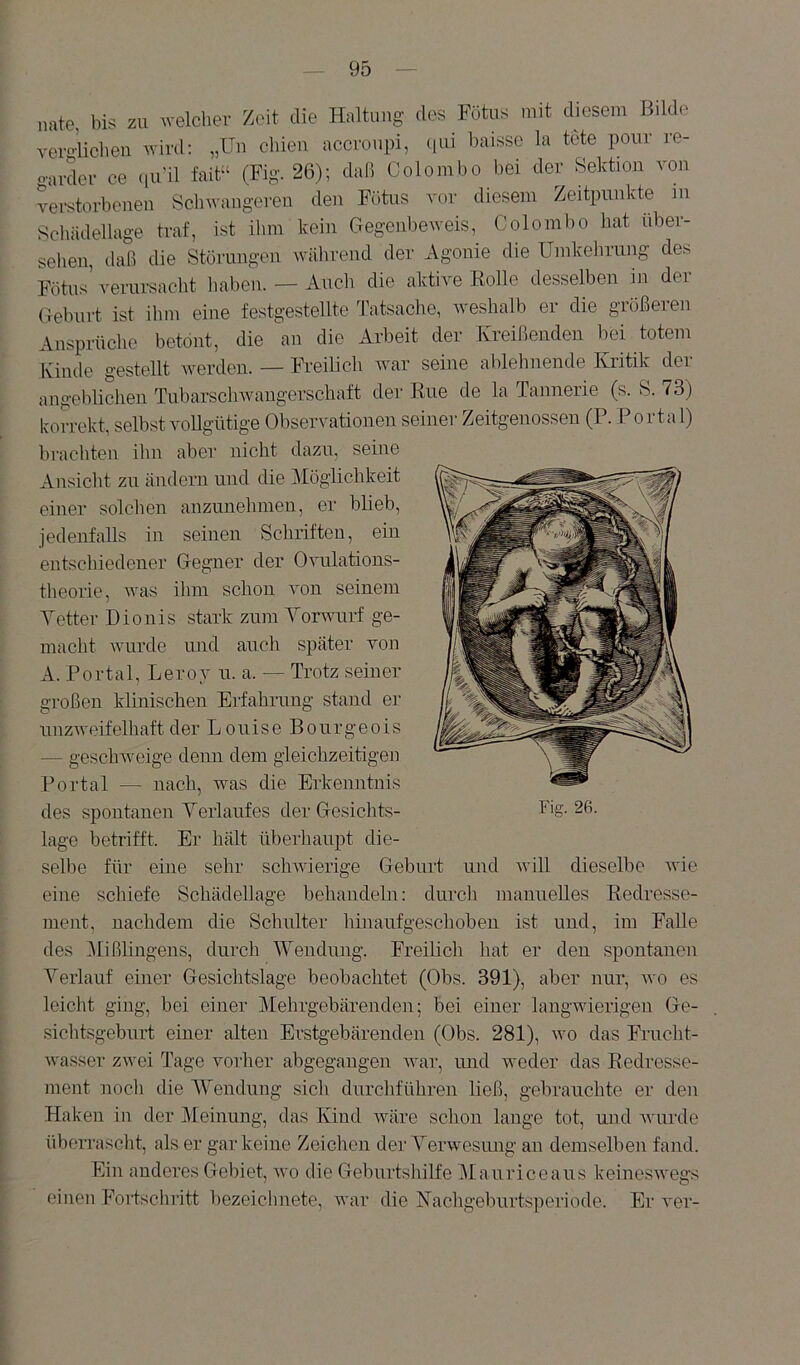 nate, bis zu welcher Zeit die Haltung des Fütus mit diesem Bilde verHicheu wird: „Un cliien accroupi, ([iii l)aisse la tete ponr re- o-arder ce qu’il fait“ (Fig. 26); daß Colombo bei der Sektion von vei-storbenen Schwangeren den Fötus vor diesem Zeitpunkte in Scliädellage traf, ist ihm kein Gegenbeweis, Colombo hat über- sehen, daß die Störungen während der Agonie die Umkehrung des Fötus’ verursacht haben. — Auch die aktive Bolle desselben in der Geburt ist ihm eine festgestellte f^Bsache, weshalb er die größeren Ansprüche betont, die an die Arbeit der Kreißenden bei totem Kinde gestellt werden. — hAeilich war seine ablehnende Kritik der angeblichen Tubarsclnvangerschaft der Kue de la Tannerie (s. S. ^3) korrekt, selbst vollgütige Observationen seiner Zeitgenossen (P. P ortal) brachten ihn aber nicht dazu, seine Ansicht zu ändern und die Möglichkeit einer solclien anzunehmen, er blieb, jedenfalls in seinen Schriften, ein entschiedener Gegner der O^uilations- theorie, was ihm schon von seinem Yetter Dionis stark zum Yorwurf ge- macht wurde und auch später von A. Portal, Lerov u. a. — Trotz seiner großen klinischen Erfahrung stand er unzweifelhaft der L ouise Bourgeois — geschweige dem dem gleichzeitigen Portal — nach, was die Erkenntnis des spontanen Yeiiaufes der Gesichts- lage betrifft. Er hält überhaupt die- selbe für eine sehr scliAvierige Geburt und will dieselbe wie eine schiefe Schädellage behandeln: durch manuelles Bedresse- ment, nachdem die Schulter hinaufgeschoben ist und, im Falle des ^lißlingens, durch Wendung. Freilich hat er den spontanen Yeiiauf einer Gesichtslage beobachtet (Obs. 391), aber nur, w'o es leicht ging, bei einer Mehrgebärenden; bei einer langwierigen Ge- .sichtsgeburt einer alten Erstgebärenden (Obs. 281), wo das Frucht- Ava.sser zwei Tage vorher abgegangen Avar, und weder das Bedresse- ment noch die AYendung sich durchführen ließ, gebrauchte er deu Haken in der Aleinung, das Kind Aväre schon lange tot, und Avurde überrasclit, als er gar keine Zeichen der A^erwesimg an demselben fand. Ein anderes Gebiet, avo die Geburtshilfe Alauriceaus keinesAvegs einen Fortschritt hezeiclinete, Avar die Nachgeburtsperiode. Er A'er- Fig. 26.