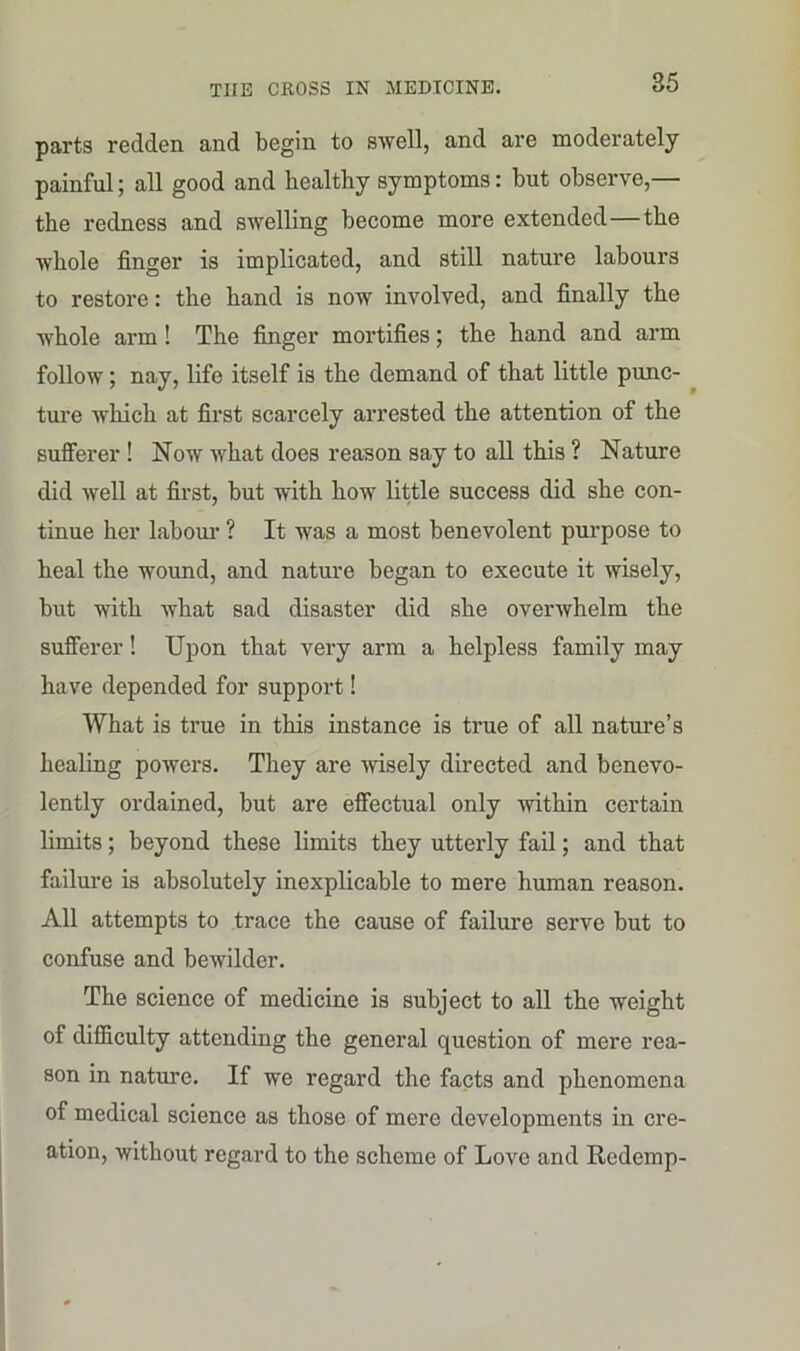 pai’ts redden and begin to swell, and are moderately painful; all good and healthy symptoms: hut observe,— the redness and swelling become more extended—the whole finger is implicated, and still nature labours to restore: the hand is now involved, and finally the whole arm! The finger mortifies; the hand and arm follow; nay, life itself is the demand of that little punc- ture which at first scarcely arrested the attention of the sufferer ! Now what does reason say to all this ? Nature did well at first, but with how little success did she con- tinue her labour ? It was a most benevolent purpose to heal the wound, and nature began to execute it wisely, but with what sad disaster did she overwhelm the sufferer! Upon that very arm a helpless family may have depended for support! What is true in this instance is true of all nature’s healing powers. They are wisely directed and benevo- lently ordained, but are effectual only within certain limits; beyond these limits they utterly fail; and that failure is absolutely inexplicable to mere human reason. All attempts to trace the cause of failure serve but to confuse and bewilder. The science of medicine is subject to all the weight of difficulty attending the general question of mere rea- son in nature. If we regard the facts and phenomena of medical science as those of mere developments in cre- ation, without regard to the scheme of Love and Redemp-