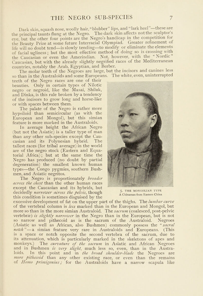 Dark skin, squash nose, woolly hair,‘‘blubber” lips, and “lark heel these are the principal taunts flung at the Negro. The dark skin affects not the sculptors eye, but the other four points are the Negro’s handicap in the competition for the Beauty Prize at some future Interracial Olympiad. Gieatei refinement of life will no doubt tend—is slowly tending—to modify or eliminate the elements of facial ugliness ; but the most effective method of doing so is crossing with the Caucasian or even the Amerindian. Not, however, with the “Nordic” Caucasian, but with the already slightly negrified races of the Mediterranean countries, notably the Arab, Egyptian, and Berber. The molar teeth of the Negroes are large, but the incisors and canines less so than in the Australoids and some Europeans. The white, even, uninterrupted teeth of the Negro races are one of their beauties. Only in certain types of Nilotic negro or negroid, like the Masai, Shiluk, and Dinka, is this rule broken by a tendency of the incisors to grow long and horse-like or with spaces between them. The palate of the Negro is rather more hypsiloid than semicircular (as with the European and Mongol), but this simian feature is more marked in the Australoids. In average height the African Negro (but not the Asiatic) is a taller type of man than any other sub-species except the Cau- casian and its Polynesian hybrid. The tallest races (for tribal average) in the world are of the negro stock (Eastern and Equa- torial Africa); but at the same time the Negro has produced (no doubt by partial degeneration) the smallest known human types—the Congo pygmies, southern Bush- men, and Asiatic negritos. The Negro is proportionately broader across the chest than the other human races except the Caucasian and its hybrids, but decidedly narrower across the pelvis, though this condition is sometimes disguised by the excessive development of fat on the upper part of the thighs. The lumbar curve of the vertebral column is less marked than in the European and Mongol, but more so than in the more simian Australoid. The sacrum (coalesced, post-pelvic vertebrae) is slightly narrower in the Negro than in the European, but is not so narrow and pithecoid as is the sacrum of the Australoid. Negroes (Asiatic as well as African, also Bushmen) commonly possess the “sacral notch ”— a simian feature very rare in Australoids and Europeans. (This is a space or notch opposite the second vertebra of the sacrum, due to its attenuation, which is particularly marked in the skeletons of apes and monkeys.) The curvature of the sacrum in Asiatic and African Negroes and in Bushmen is very slight, much less so, even, than in the Austra- loids. In this point and in the broad shoulder-blade the Negroes are more pithecoid than any other existing race, or even than the remains of Homo primigenius; for the Australoids have a narrow scapula like 5. THE MONGOLIAN TYPE A Chinaman from Eastern China