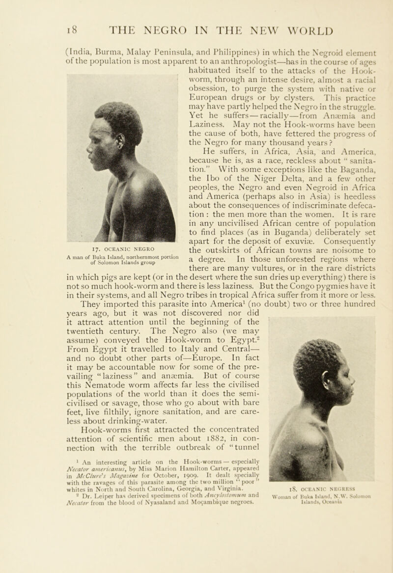 (India, Burma, Malay Peninsula, and Philippines) in which the Negroid element of the population is most apparent to an anthropologist—has in the course of ages habituated itself to the attacks of the Hook- worm, through an intense desire, almost a racial obsession, to purge the system with native or European drugs or by clysters. This practice may have partly helped the Negro in the struggle. Yet he suffers—racially—from Anaemia and Laziness. May not the Hook-worms have been the cause of both, have fettered the progress of the Negro for many thousand years? He suffers, in Africa, Asia, and America, because he is, as a race, reckless about “ sanita- tion.” With some exceptions like the Baganda, the I bo of the Niger Delta, and a few other peoples, the Negro and even Negroid in xLfrica and America (perhaps also in Asia) is heedless about the consequences of indiscriminate defeca- tion : the men more than the women. It is rare in any uncivilised African centre of population to find places (as in Buganda) deliberately set apart for the deposit of exuviae. Consequently the outskirts of African towns are noisome to a degree. In those unforested regions where there are many vultures, or in the rare districts in which pigs are kept (or in the desert where the sun dries up everything) there is not so much hook-worm and there is less laziness. But the Congo pygmies have it in their systems, and all Negro tribes in tropical Africa suffer from it more or less. They imported this parasite into America1 (no doubt) two or three hundred years ago, but it was not discovered nor did it attract attention until the beginning of the twentieth century. The Negro also (we may assume) conveyed the Hook-worm to Egypt.2 Erom Egypt it travelled to Italy and Central— and no doubt other parts of—Europe. In fact it may be accountable now for some of the pre- vailing “laziness” and anaemia. But of course this Nematode worm affects far less the civilised populations of the world than it does the semi- civilised or savage, those who go about with bare feet, live filthily, ignore sanitation, and are care- less about drinking-water. Hook-worms first attracted the concentrated attention of scientific men about 1882, in con- nection with the terrible outbreak of “ tunnel 1 An interesting article on the Hook-worms — especially Neca/or aviericanns, by Miss Marion Hamilton Carter, appeared in McClure's Magazine for October, 1909. It dealt specially with the ravages of this parasite among the two million “ poor ” whites in North and South Carolina, Georgia, and Virginia. 2 Dr. Leiper has derived specimens of both Ancylostomum and Necator from the blood of Nyasaland and Mozambique negroes. l8. OCEANIC NEGRESS Woman of Buka Island, N.W . Solomon Islands, Oceania 17. OCEANIC NEGRO A man of Buka Island, northernmost portion of Solomon Islands group