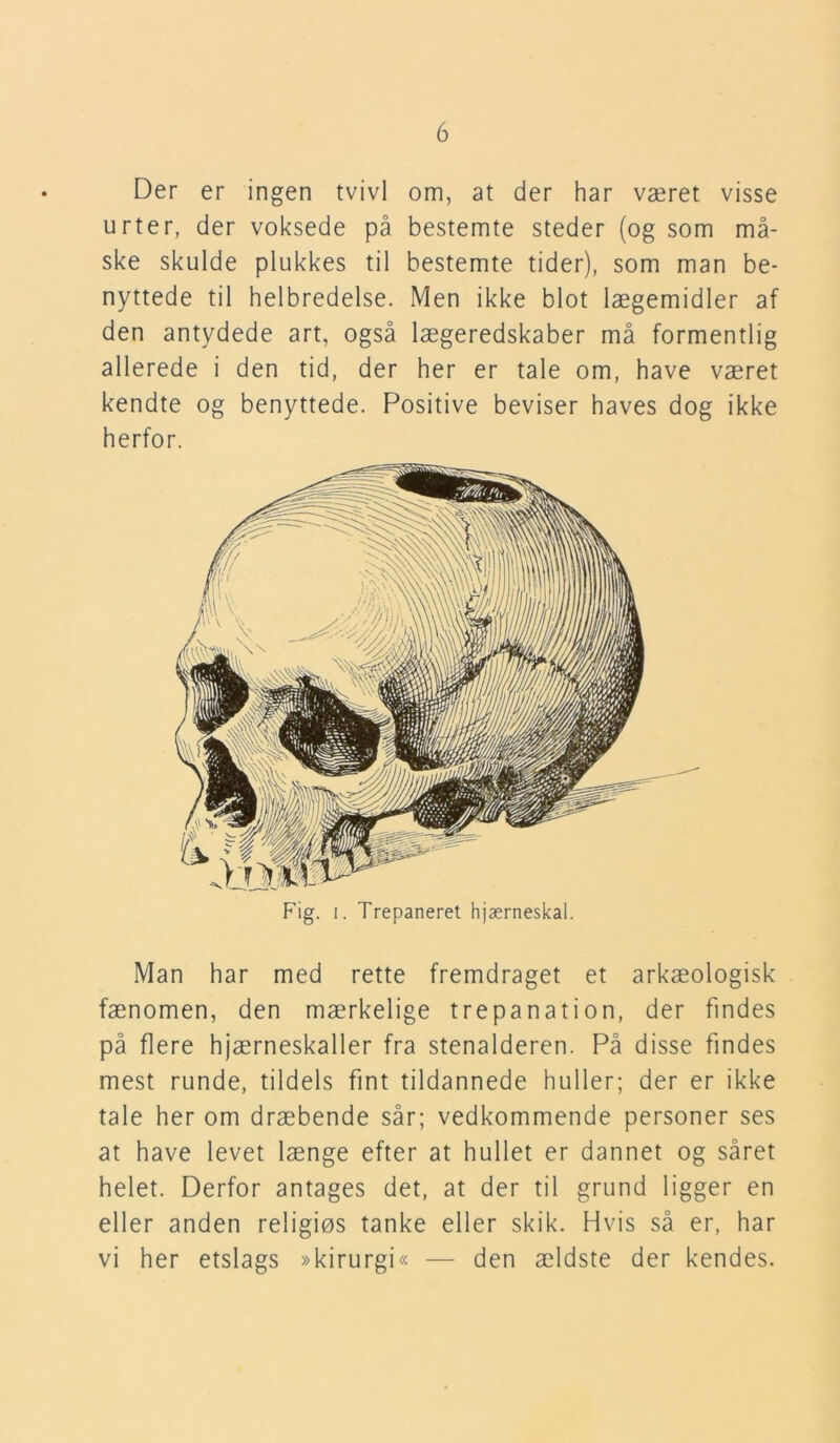 Der er ingen tvivl om, at der har været visse urter, der voksede på bestemte steder (og som må- ske skulde plukkes til bestemte tider), som man be- nyttede til helbredelse. Men ikke blot lægemidler af den antydede art, også lægeredskaber må formentlig allerede i den tid, der her er tale om, have været kendte og benyttede. Positive beviser haves dog ikke herfor. Fig. i. Trepaneret hjærneskal. Man har med rette fremdraget et arkæologisk fænomen, den mærkelige trepanation, der findes på flere hjærneskaller fra stenalderen. På disse findes mest runde, tildels fint tildannede huller; der er ikke tale her om dræbende sår; vedkommende personer ses at have levet længe efter at hullet er dannet og såret helet. Derfor antages det, at der til grund ligger en eller anden religiøs tanke eller skik. Hvis så er, har vi her etslags »kirurgi« — den ældste der kendes.