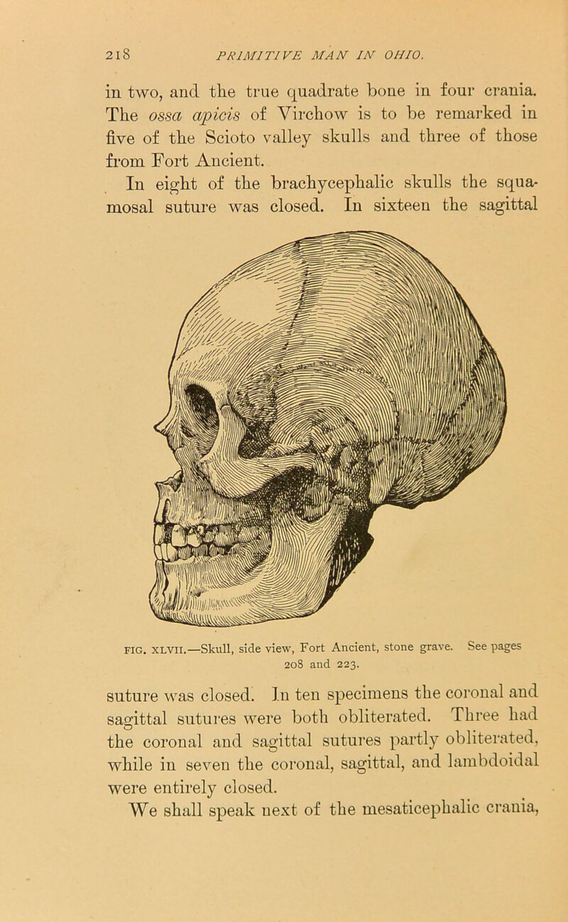 in two, and the true quadrate bone in four crania. The ossa apicis of Virchow is to be remarked in five of the Scioto valley skulls and three of those from Fort Ancient. In eight of the brachycephalic skulls the squa- mosal suture was closed. In sixteen the sagittal fig. xlvii.—Skull, side view, Fort Ancient, stone grave. See pages 208 and 223. suture was closed. In ten specimens the coronal and sagittal sutures were both obliterated. Three had the coronal and sagittal sutures partly obliterated, while in seven the coronal, sagittal, and lambdoidal were entirely closed. We shall speak uext of the mesaticephalic crania,