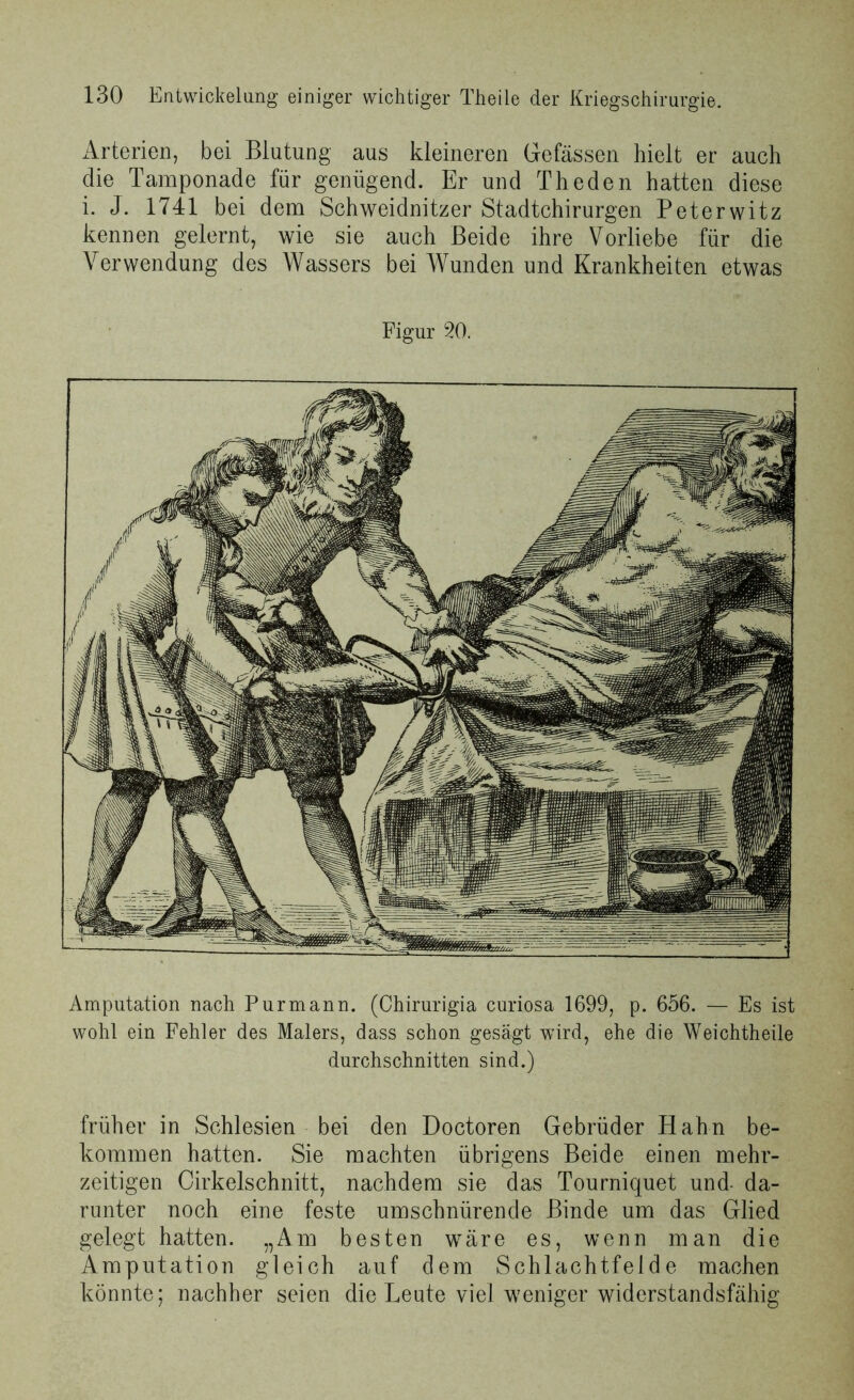 xArterien, bei Blutung aus kleineren Gefässen hielt er auch die Tamponade für genügend. Er und Theden hatten diese i. J. 1741 bei dem Schweidnitzer Stadtchirurgen Peterwitz kennen gelernt, wie sie auch Beide ihre Vorliebe für die Verwendung des Wassers bei Wunden und Krankheiten etwas Figur 20. Amputation nach Pur mann. (Chirurigia curiosa 1699, p. 656. — Es ist wohl ein Fehler des Malers, dass schon gesägt wird, ehe die Weichtheile durchschnitten sind.) früher in Schlesien bei den Doctoren Gebrüder Hahn be- kommen hatten. Sie machten übrigens Beide einen mehr- zeitigen Cirkelschnitt, nachdem sie das Tourniquet und- da- runter noch eine feste umschnürende Binde um das Glied gelegt hatten. „Am besten wäre es, wenn man die Amputation gleich auf dem Schlachtfelde machen könnte; nachher seien die Leute viel weniger widerstandsfähig