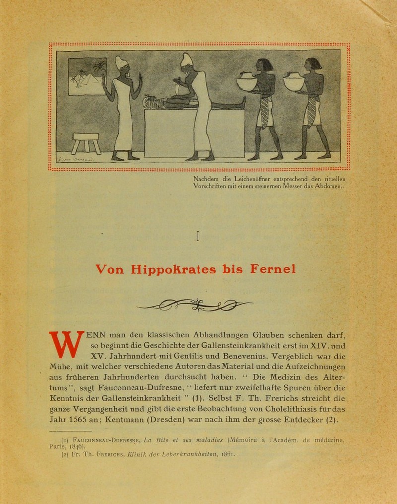 Nachdem die Leichenöffner entsprechend den rituellen Vorschriften mit einem steinernen Messer das Abdomen.. 1 Von HippoKrates bis Fernei WENJST man den klassischen Abhandlungen Glauben schenken darf, so beginnt die Geschichte der Gallensteinkrankheit erst im XIV. und XV. Jahrhundert mit Gentilis und Benevenius. Vergeblich war die Mühe, mit welcher verschiedene Autoren das Material und die Aufzeichnungen aus früheren Jahrhunderten durchsucht haben. “ Die Medizin des Alter- tums”, sagt Fauconneau-Dufresne, “ liefert nur zweifelhafte Spuren über die Kenntnis der Gallensteinkrankheit ” (1). Selbst F. Th. Frerichs streicht die ganze Vergangenheit und gibt die erste Beobachtung von Cholelithiasis für das Jahr 1565 an; Kentmann (Dresden) war nach ihm der grosse Entdecker (2). (i) Fauconneau-Dufresne, La Bile et ses maladies (Mdmoire ä l’Academ. de medecine, Paris, 1846).