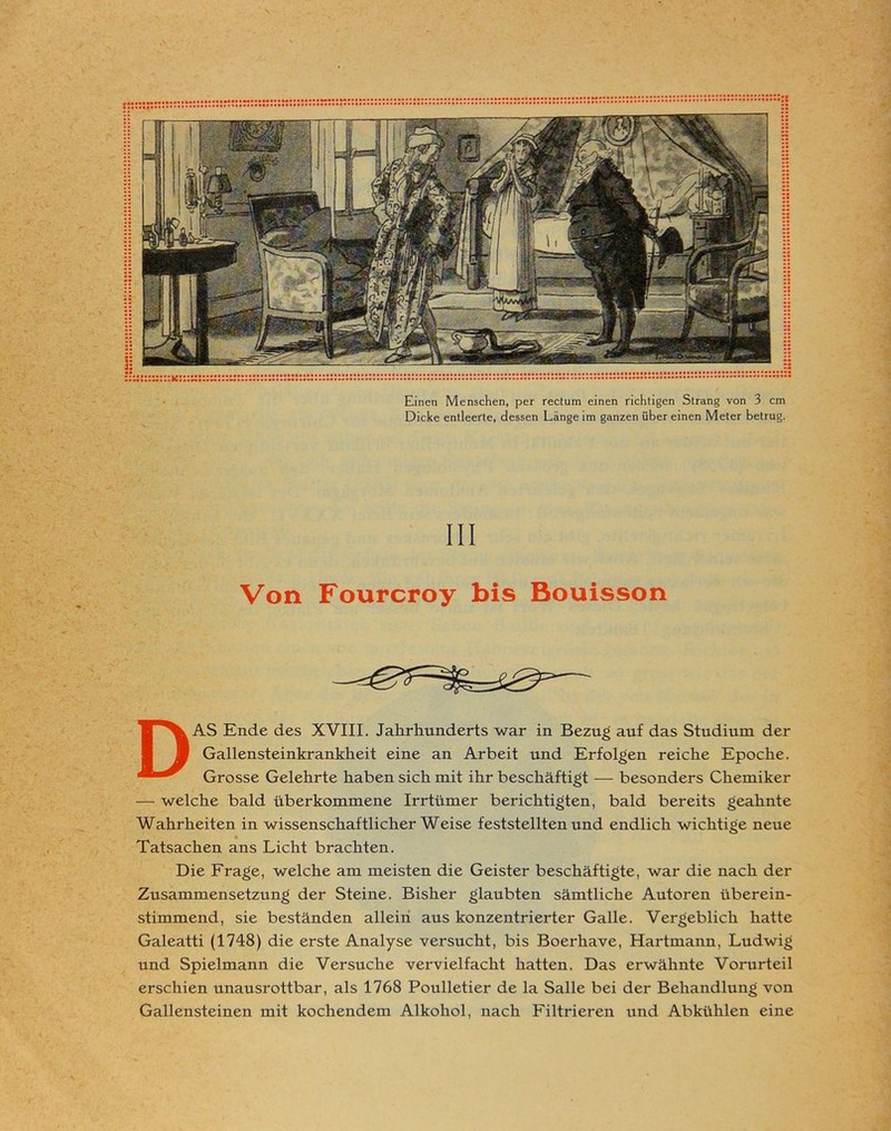 Einen Menschen, per rectum einen richtigen Strang von 3 cm Dicke entleerte, dessen Länge im ganzen über einen Meter betrug. III Von Fourcroy bis Bouisson DAS Ende des XVIII. Jahrhunderts war in Bezug auf das Studium der Gallensteinkrankheit eine an Arbeit und Erfolgen reiche Epoche. Grosse Gelehrte haben sich mit ihr beschäftigt — besonders Chemiker — welche bald überkommene Irrtümer berichtigten, bald bereits geahnte Wahrheiten in wissenschaftlicher Weise feststellten und endlich wichtige neue Tatsachen ans Licht brachten. Die Frage, welche am meisten die Geister beschäftigte, war die nach der Zusammensetzung der Steine. Bisher glaubten sämtliche Autoren überein- stimmend, sie beständen allein aus konzentrierter Galle. Vergeblich hatte Galeatti (1748) die erste Analyse versucht, bis Boerhave, Hartmann, Ludwig und Spielmann die Versuche vervielfacht hatten. Das erwähnte Vorurteil erschien unausrottbar, als 1768 Poulletier de la Salle bei der Behandlung von Gallensteinen mit kochendem Alkohol, nach Filtrieren tind Abkühlen eine