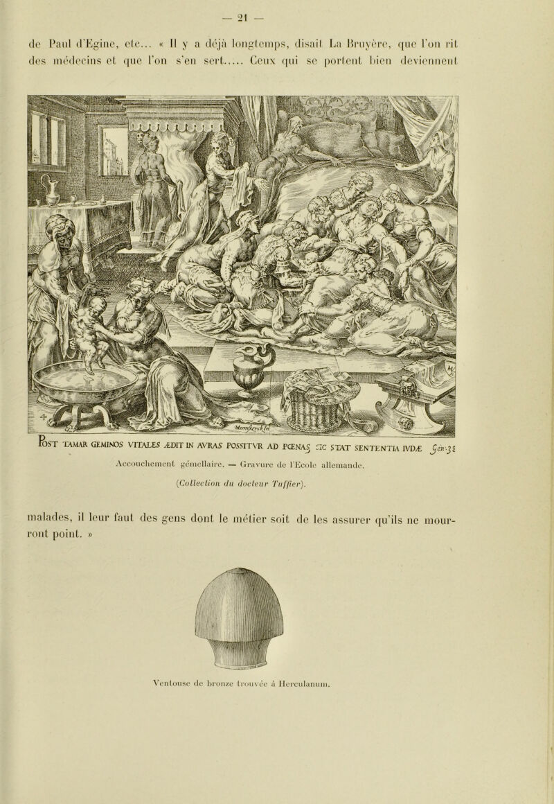lie Paul d'Pgiiio, Hc. (les mcMlocins cl. (|uc . « Il y a (Icjà loii(om|)s, disail I^a Bniycia', Pou s'cn sert Ceux (iin sc porlciiL hicii (HIC l’oii ril dovicimcul Accoucliement ycinellairc. — Cjravurc de l’Ecole allemande. {CoUeclion du docteur Tuffier). malades, il leur faut des gens dont le mélier soit de les assurer qu’ils iie mour- ront point. » \^c‘nlous(.‘ (le bronze lintivée à Ilerculannm. 1 f 1 \ f i t s