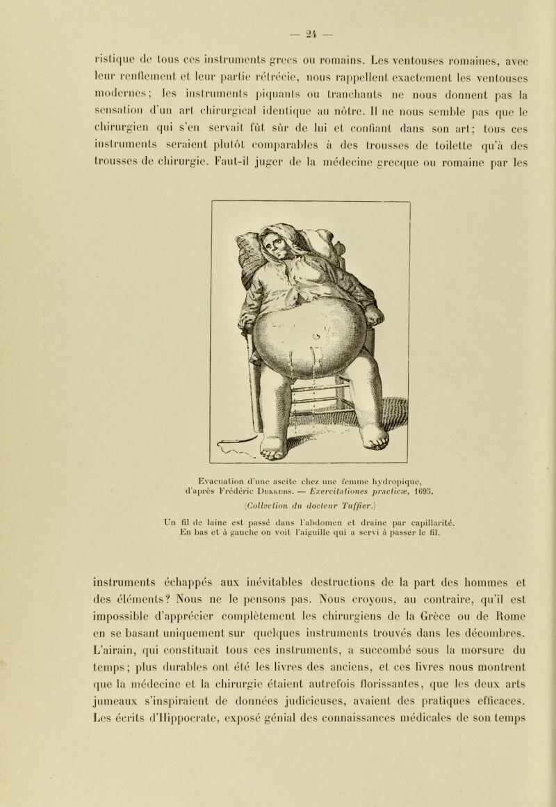 ris(i(|iic (lo tous cos iiisli-umonts forces ou romains. Les ventouses romaines, avec leur renlleuu'ut e( leur ))ai‘li(‘ l’élrccic', nous ra|)|)ellent exactement les venlouses modernes; les insiruments j)i(|uanls ou trancliants ne nous donnent pas la S('nsalion d un ar( (diiiairj^ical idenli(|U(‘ au nùti'e. Il ne nous seioble pas cpie le chirurgieu qui s’eu servait fût sûr de lui et confiant dans son art; tous ces insiruments seraient plulôt comparables à des (rousses de toilette qu’à des trousses de ebirurgie. Faut-il juger de la médecine greccpie ou romaine par les Evacuation d'une ascite chez une l'cinme liydropiquc, d’aj)i-ès Frédéric Dickkeus. — ExerciUxütmes praclicæ, lG9o. [Colleclion du docteur Tiif/ier.) Un fil de laine est [lassé dans l’abdonicn et draine jiar capillarité. En bas et à yauclic on voit l’aiguille qui a ser\i à passer le lîl. instruments échappés aux inévitables destructions de la part des hommes et des éléments? Nous ne le pensons pas. Nous croyons, au contraire, qu’il est impossible d’apprécier complètement les chirurgiens de la Grèce ou de Rome en se basant uniquement sur quelques instruments trouvés dans les décombres. L’ainiin, qui constituait tous ces instruments, a succombé sous la morsure du temps; plus durables ont été les livres des anciens, et ces livres nous montrent (pie la médecine et la chirurgie étaient autrefois (lorissautes, cpie les deux arts jumeaux s’ins[)iraient de données judicieuses, avaient des pratiques efticaces. Les écrits d’Ilijijiocrate, exposé génial des connaissances médicales de son temps