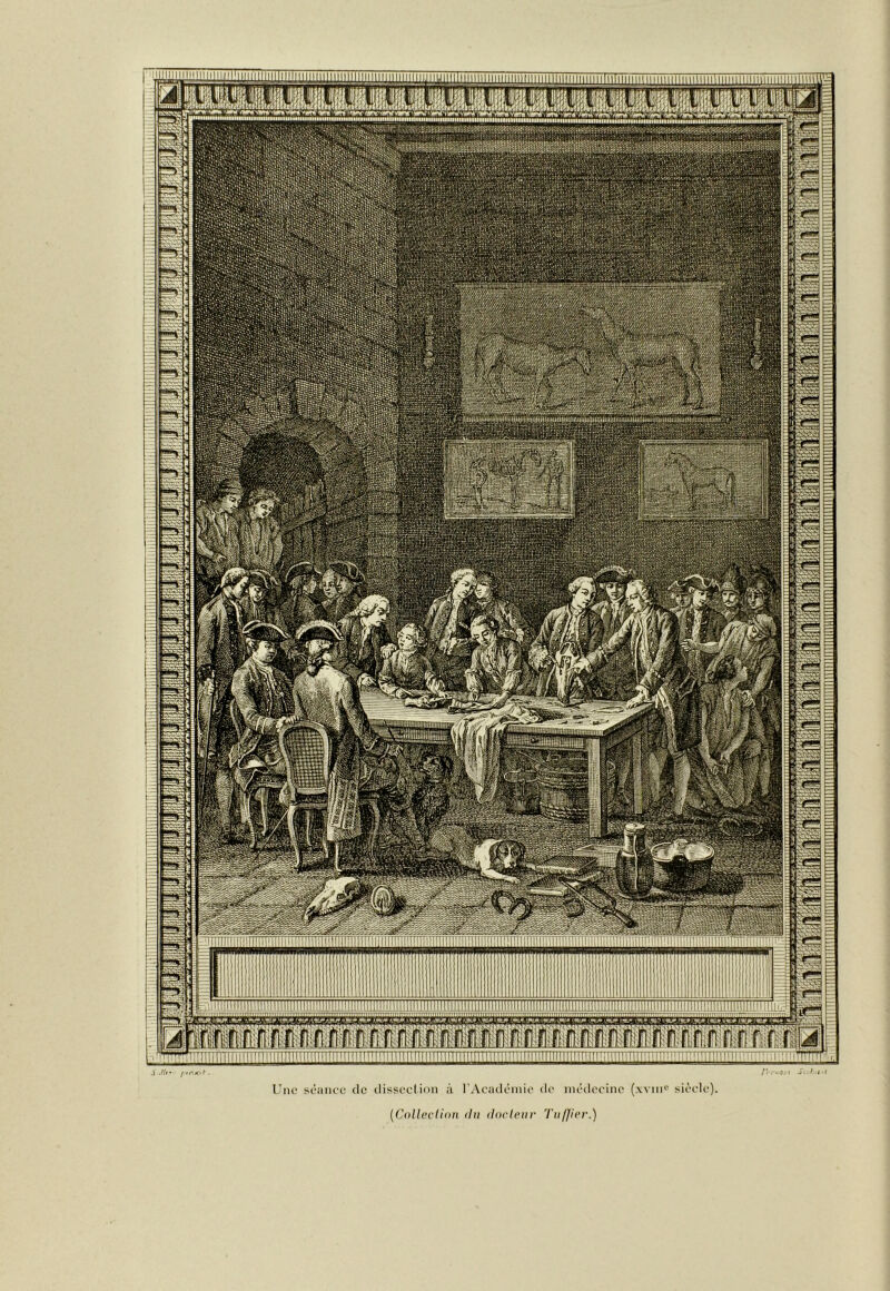 rm* sl'atuc (le disseclinii à l'AcjuU'mi(‘ de médecine (w ui*’ siècle). (CoUevIion iln iloririir Tnifior.)