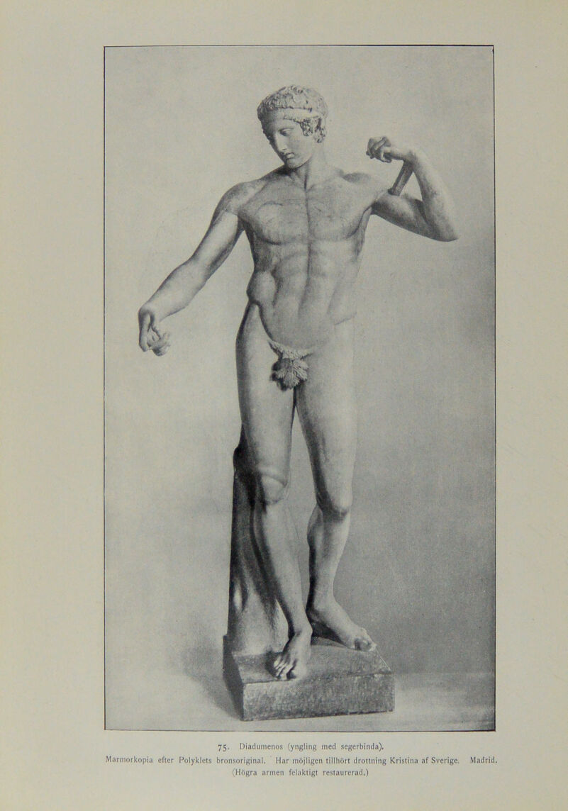 Marmorkopia efter Polyklets bronsoriginal. Har möjligen tillhört drottning Kristina af Sverige. Madrid. (Högra armen felaktigt restaurerad.)