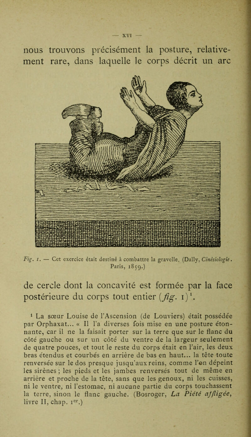 nous trouvons précisément la posture, relative- ment rare, dans laquelle le corps décrit un arc Fig. i. — Cet exercice était destiné à combattre la gravelle. (Daily. Cinésiologie. Paris, 1859.) de cercle dont la concavité est formée par la face postérieure du corps tout entier [fig. i)1. 1 La sœur Louise de l’Ascension (de Louviers) était possédée par Orphaxat... « Il l'a diverses fois mise en une posture éton- nante, car il ne la faisait porter sur la terre que sur le flanc du côté gauche ou sur un côté du ventre de la largeur seulement de quatre pouces, et tout le reste du corps était en l’air, les deux bras étendus et courbés en arrière de bas en haut... la tête toute renversée sur le dos presque jusqu’aux reins, comme Pon dépeint les sirènes ; les pieds et les jambes renversés tout de même en arrière et proche de la tête, sans que les genoux, ni les cuisses, ni le ventre, ni l’estomac, ni aucune partie du corps touchassent la terre, sinon le flanc gauche. (Bosroger, La Piété ajfligée, livre II, chap. ier.)