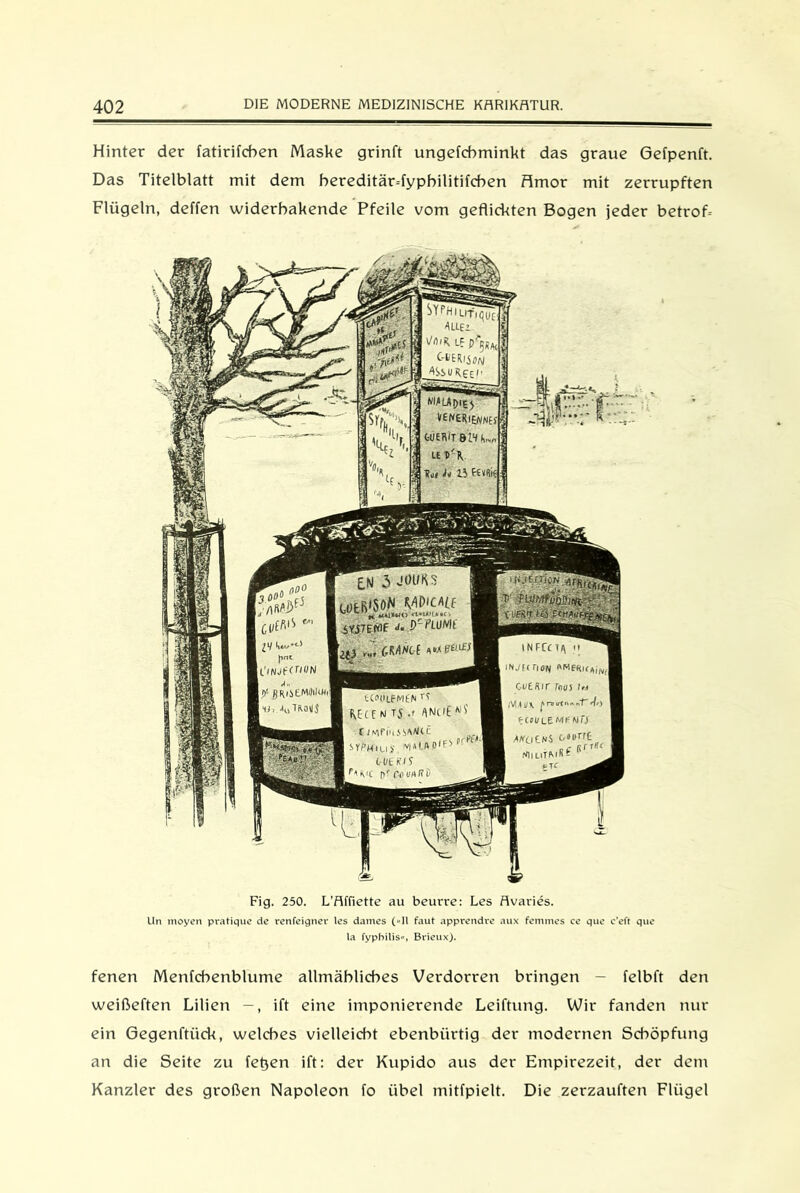 Hinter der fatirifchen Maske grinft ungefchminkt das graue Gefpenft. Das Titelblatt mit dem bereditärTypbilitifcben Amor mit zerrupften Flügeln, deffen widerbakende Pfeile vom geflickten Bogen jeder betrof-- SYPHI LITifil AUE’ \Jt)iK if CtERiiOft/ ASsu Ree '• MAU DIE) ^ElUEAfNEf C-ÜERIT »LH U LETl'K h ii fEVRis j t()tRi50N W'c*lt **41»*<> <t-*t«!£•■<'. SYiTEtflf PLUMt IH pnc ll'lNjfUK/N 5 (Mk-i ^ INFCCTR ii lN./f( HON I'MERK*,,, CüERir rnus 1#4 (VMUX fni4'\ ECtl/LEMH wo MtitNS c.Di/rrt - fr r Tfft niil»tm:M r l)1 ßRUCMfllkH 1), •!(.! TROIlS EUtllFMEN 1? fvEf C M T5 .f ANtit I t JMFfuJ!>AAj(.C sf/>Mluy f' ‘ ‘ OUt S(? pTfliwtfß , tTf Fig. 250. L'Affiette au beurre: Les Avaries. Un moyen pratique de renfeigner les dames (»II faut apprendre aux femmes ce que c'eft que la fyphiliS, Brieux). fenen Menfcbenblume alltnäblicbes Verdorren bringen - felbft den weißeften Lilien ift eine imponierende Leiftung. Wir fanden nur ein Gegenftiick, welches vielleicht ebenbürtig der modernen Schöpfung an die Seite zu fetjen ift: der Kupido aus der Empirezeit, der dem Kanzler des großen Napoleon fo übel mitfpielt. Die zerzauften Flügel
