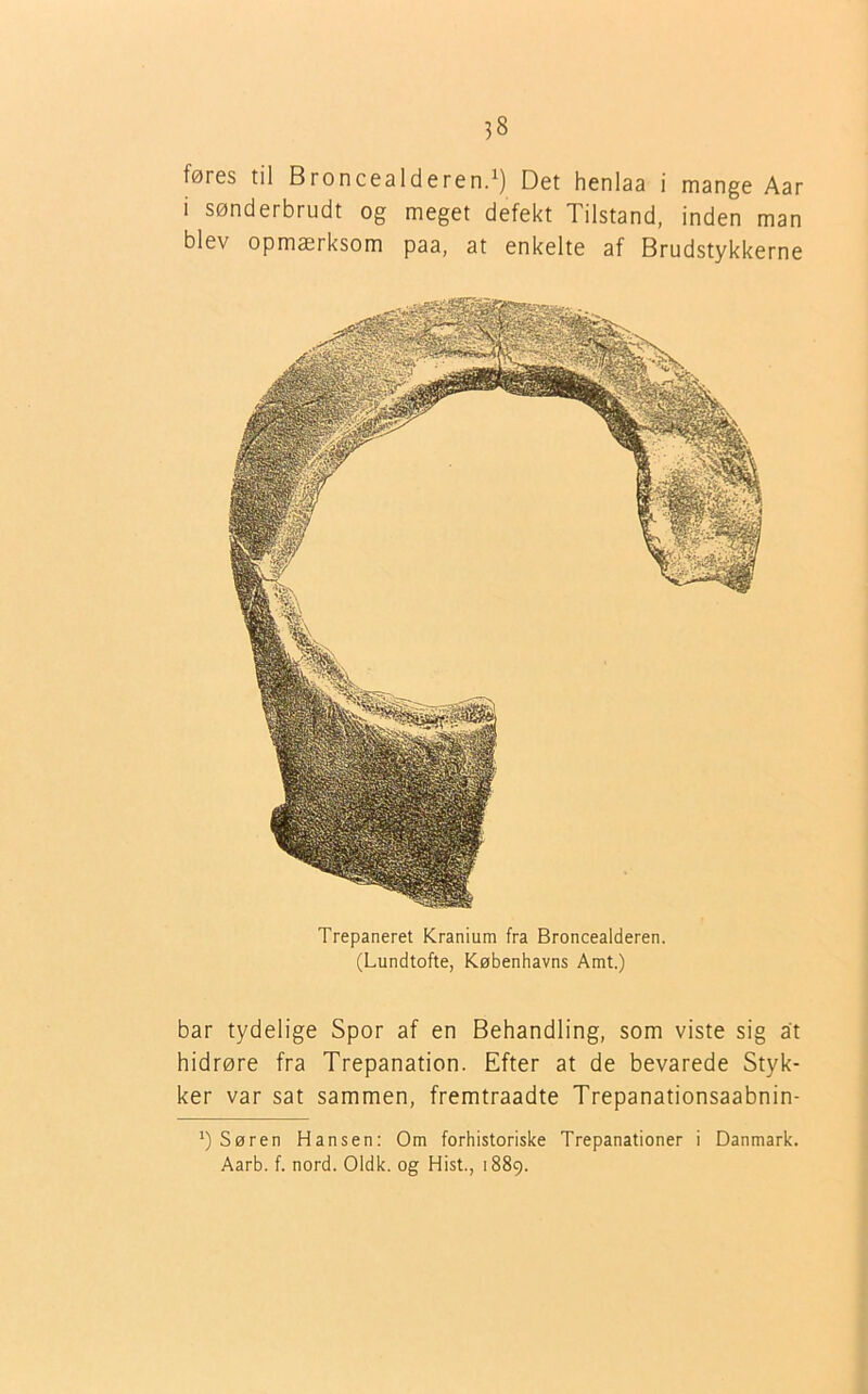 føres til Broncealderen.1) Det henlaa i mange Aar i sønderbrudt og meget defekt Tilstand, inden man blev opmærksom paa, at enkelte af Brudstykkerne Trepaneret Kranium fra Broncealderen. (Lundtofte, Københavns Amt.) bar tydelige Spor af en Behandling, som viste sig at hidrøre fra Trepanation. Efter at de bevarede Styk- ker var sat sammen, fremtraadte Trepanationsaabnin- *) Søren Hansen: Om forhistoriske Trepanationer i Danmark. Aarb. f. nord. Oldk. og Hist., 1889.
