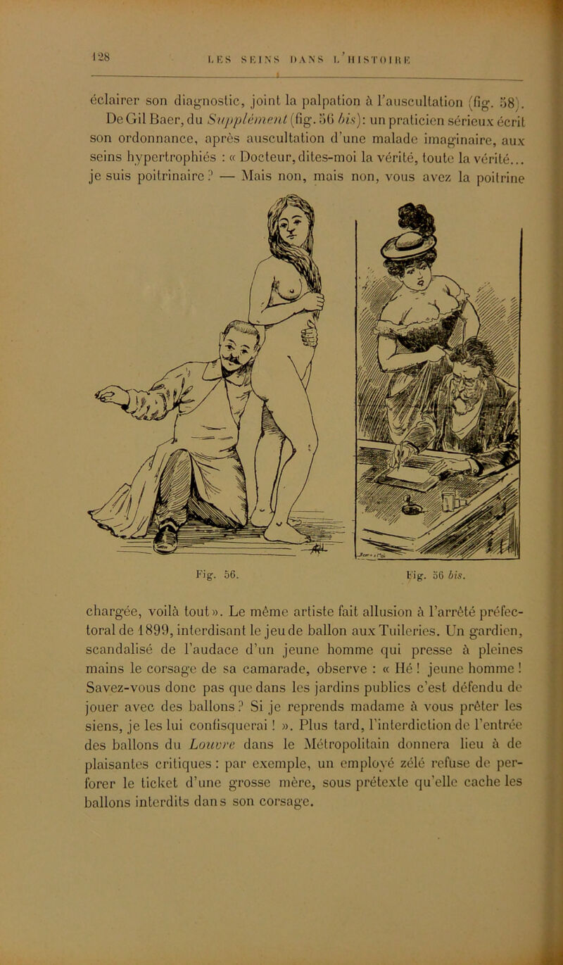 éclairer son diagnostic, joint la palpation à l’auscultation (fig. 58 De Gil Baer, du Supplément (fig. 50 bis): un praticien sérieux écrit son ordonnance, après auscultation d’une malade imaginaire, aux seins hypertrophiés : « Docteur,dites-moi la vérité, toute la vérité... je suis poitrinaire? — Mais non, mais non, vous avez la poitrine Fig. 56. Ij’ig. 56 bis. chargée, voilà tout». Le même artiste fait allusion à l’arrêté préfec- toral de 1899, interdisant le jeu de ballon aux Tuileries. Un gardien, scandalisé de l’audace d’un jeune homme qui presse à pleines mains le corsage de sa camarade, observe : « Hé ! jeune homme ! Savez-vous donc pas que dans les jardins publics c’est défendu de jouer avec des ballons? Si je reprends madame à vous prêter les siens, je les lui confisquerai ! ». Plus tard, l'interdiction de l’entrée des ballons du Louvre dans le Métropolitain donnera lieu à de plaisantes critiques: par exemple, un employé zélé refuse de per- forer le ticket d’une grosse mère, sous prétexte qu'elle cache les ballons interdits dans son corsage.