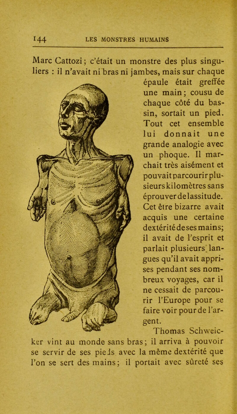 Marc Cattozi ; c’était un monstre des plus singu- liers : il n’avait ni bras ni jambes, mais sur chaque épaule était greffée une main ; cousu de chaque côté du bas- sin, sortait un pied. Tout cet ensemble lui donnait une grande analogie avec un phoque. Il mar- chait très aisément et pouvait parcourir plu- sieurs kilomètres sans éprouver de lassitude. Cet être bizarre avait acquis une certaine dextérité deses mains; il avait de l’esprit et parlait plusieursjan- gues qu’il avait appri- ses pendant ses nom- breux voyages, car il ne cessait de parcou- rir l’Europe pour se faire voir pour de l’ar- gent. Thomas Schweic- ker vint au monde sans bras; il arriva à pouvoir se servir de ses pieds avec la même dextérité que l’on se sert des mains; il portait avec sûreté ses